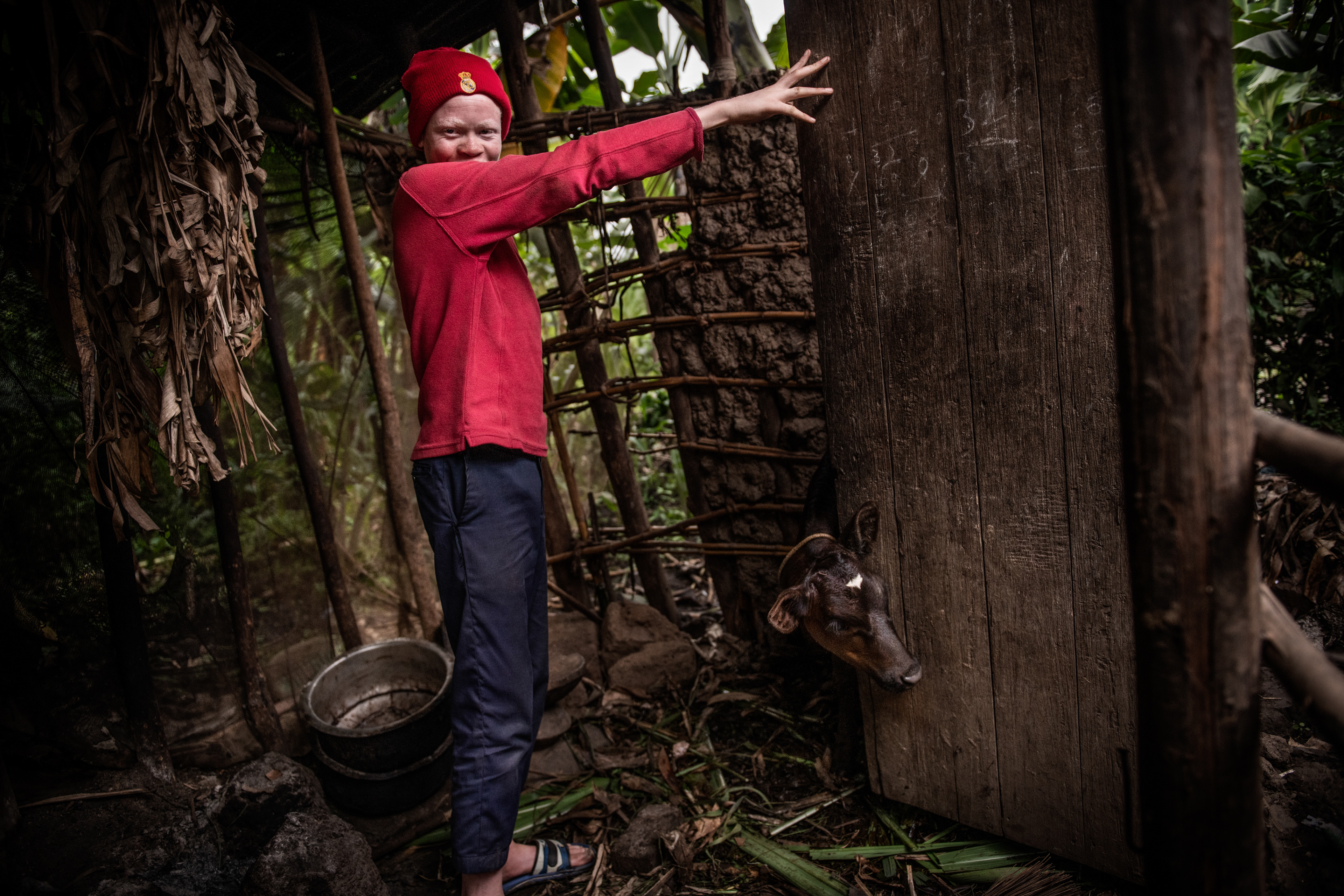 Jean Claude, 14, looks after a calf in the barn behind his home. In Rwanda, all cows must be kept indoors to prevent them from damaging other farmers’ crops. His daily chores include collecting elephant grass, which the cows eat. Jean Claude and two of his siblings have albinism. His skin is very sensitive to sunlight, and even on cloudy days, he must protect himself from the sun. Nyarutembe, Rwanda 2019
