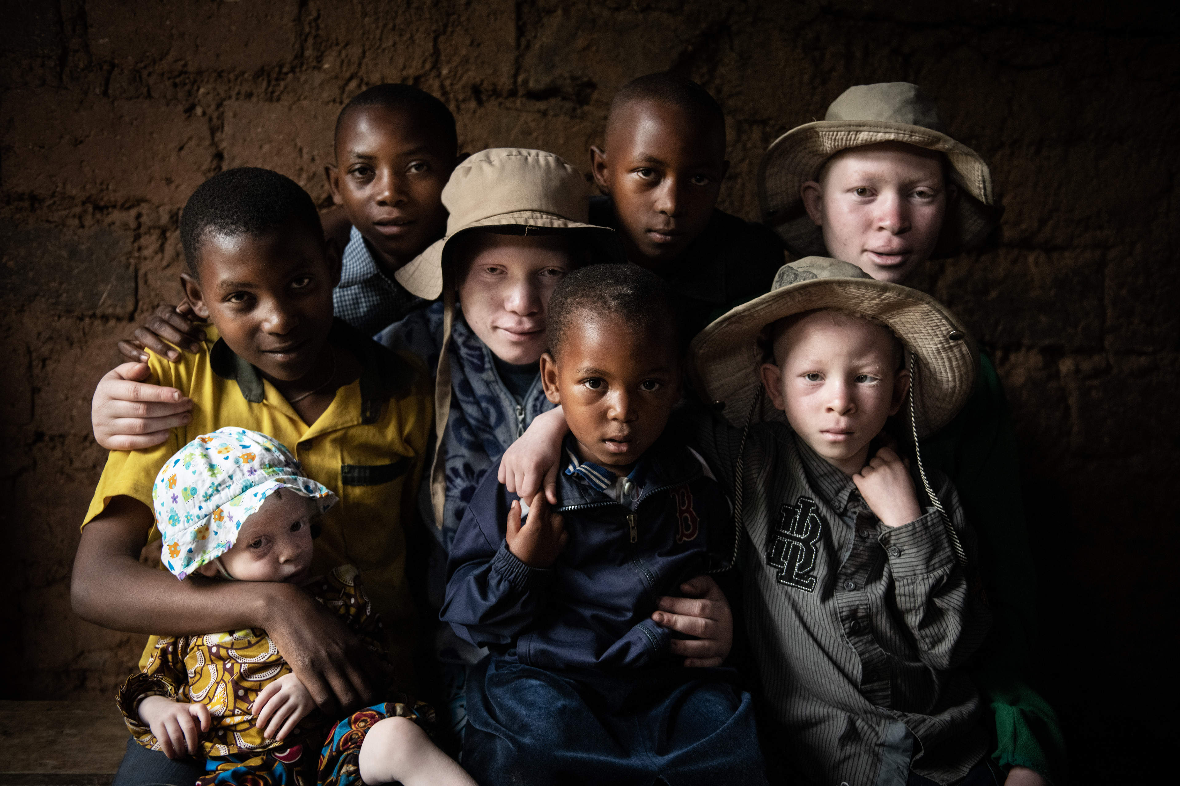 Bertina (in the middle with a hat), 19 years old, with her siblings. She has 6 sisters and a brother. Four of them are albinos. Their skin is very sensitive to sunlight, even on cloudy days they have to protect themselves from the sun, they wear wide-brimmed hats. Bertina also suffers from uneven limbs and myopia. Bertina is finishing high school, she wants to study and become a businesswoman. Ruyumba, Rwanda 2019