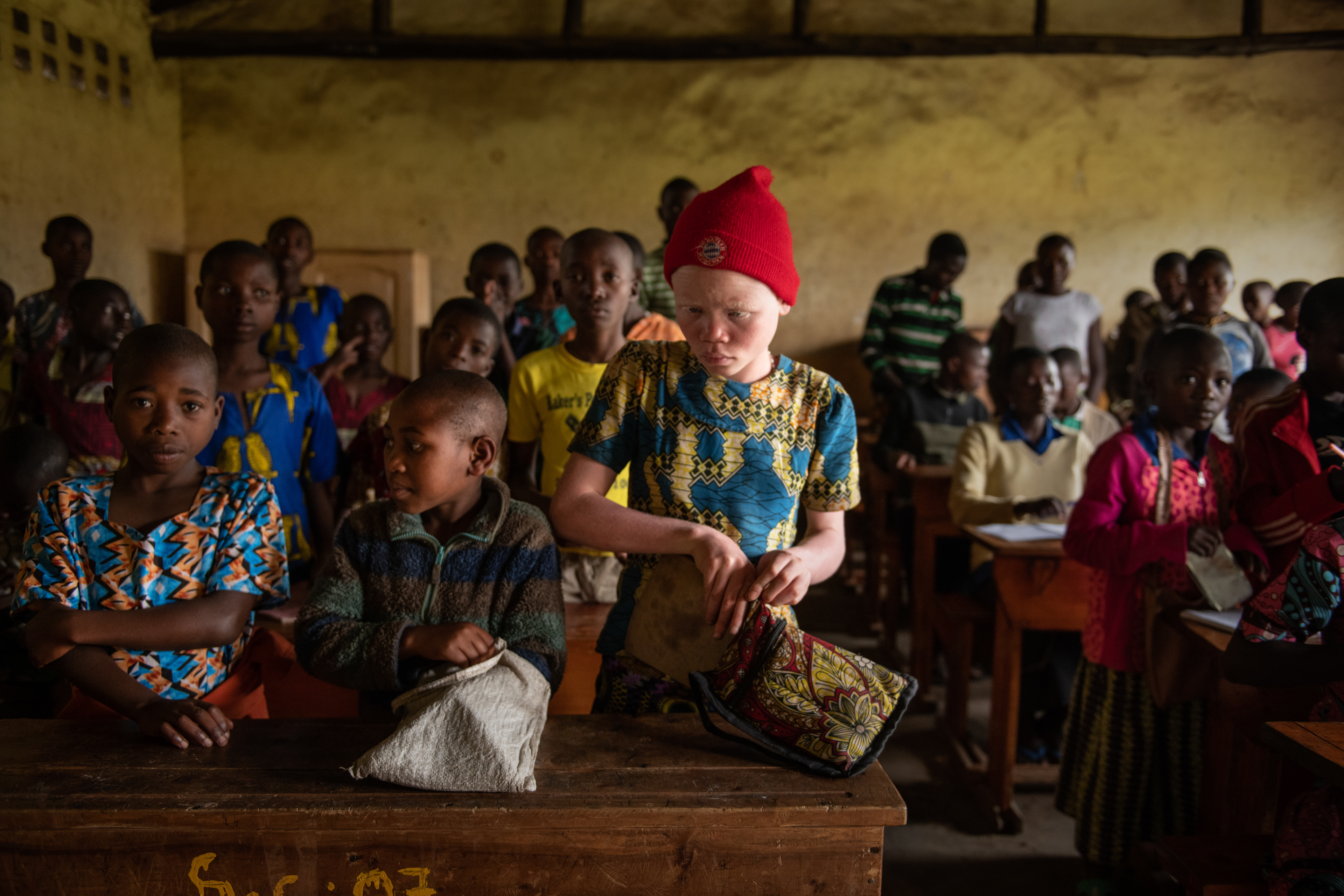 A child with albinism at a primary school in Nyakinama, Rwanda. There is no prejudice against albinos in Rwanda. Unlike in other African countries where they are discriminated against and experience violence Rwanda 2019