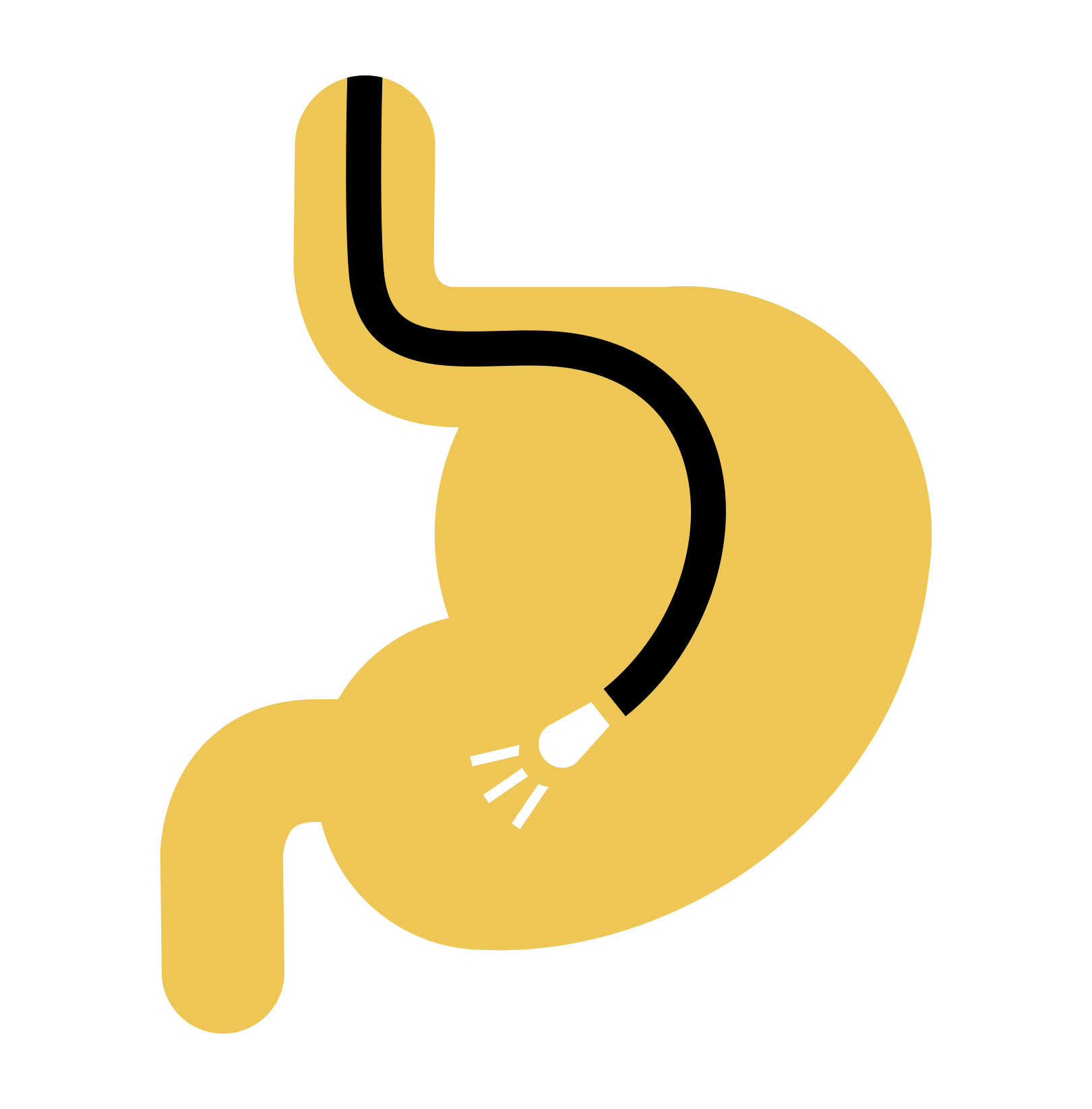 gastroscopy for endostation app