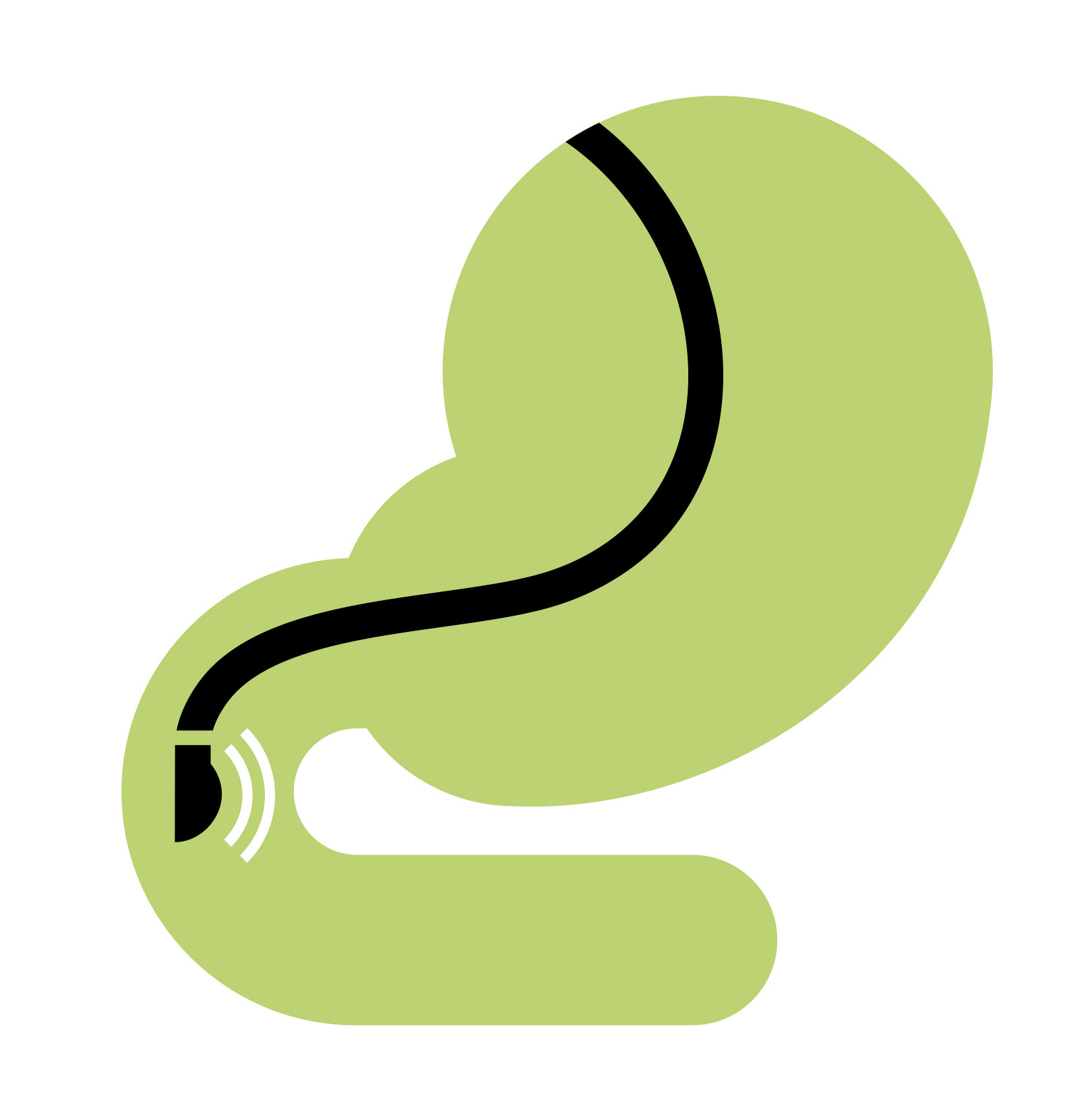 endoscopic ultrasound