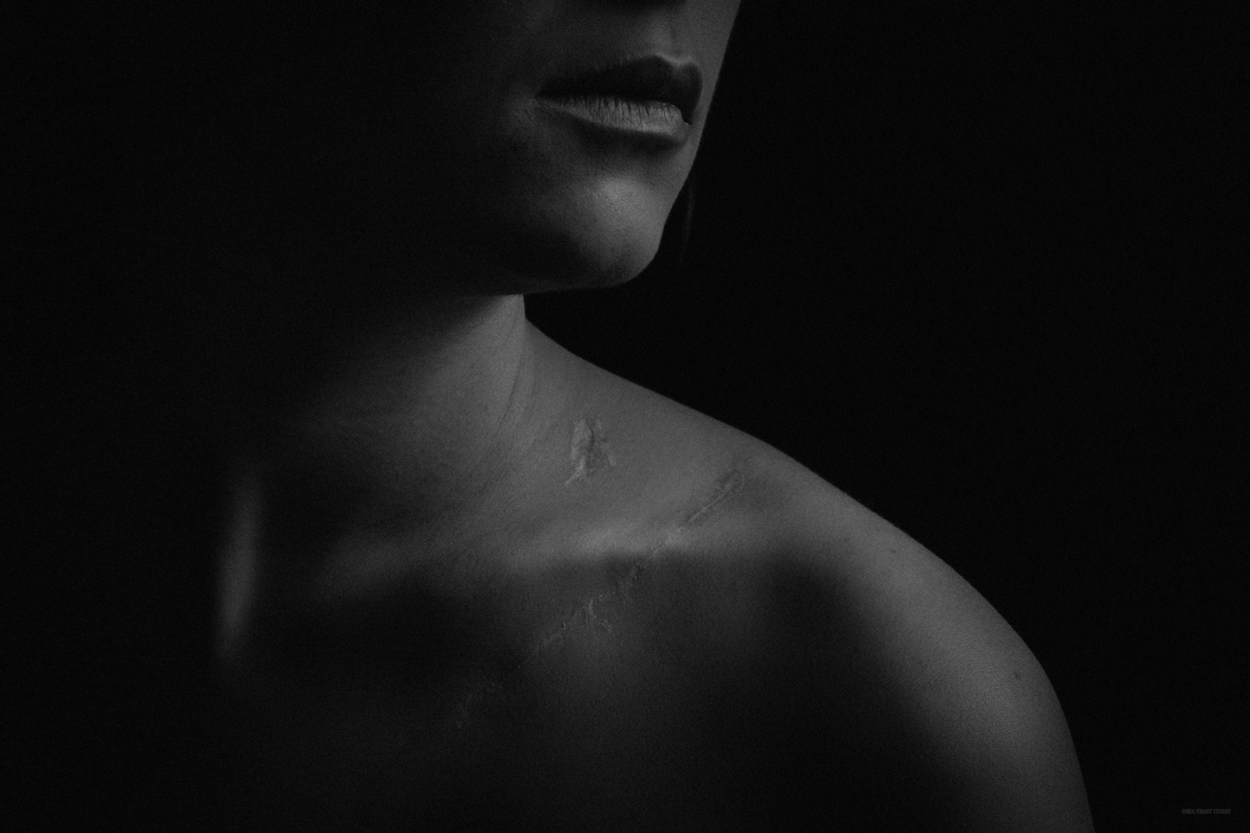 Scars - Stories of Life