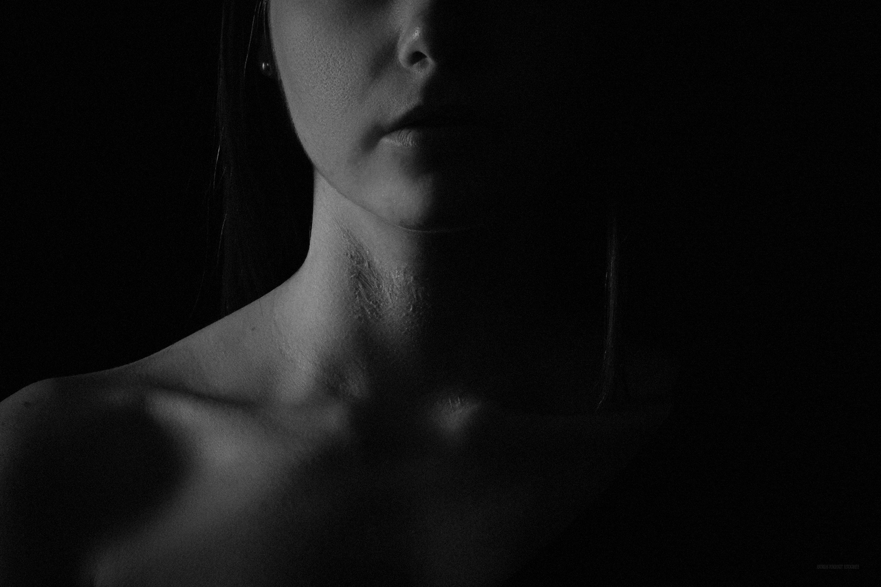 Scars - Stories of Life