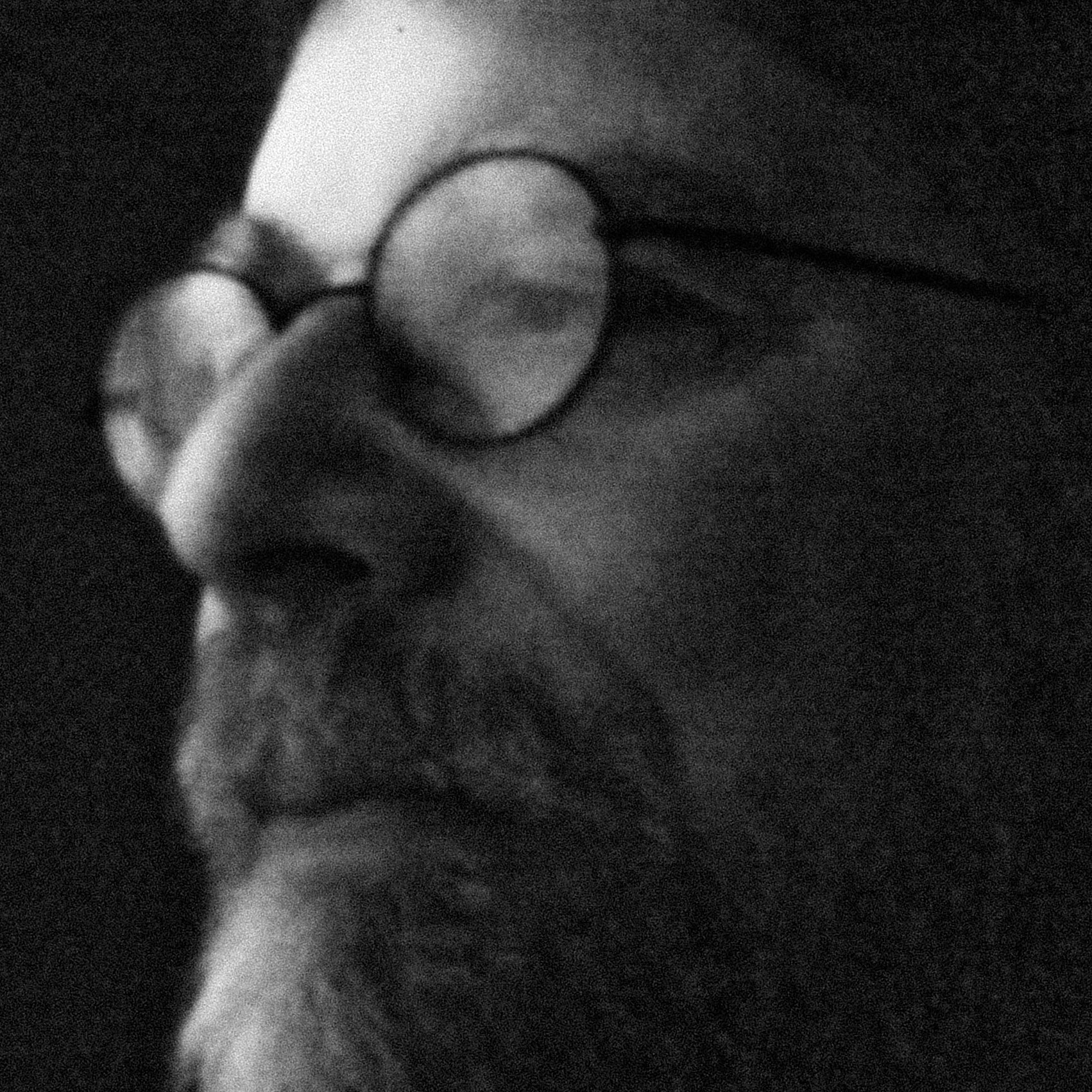 Robert David After The War