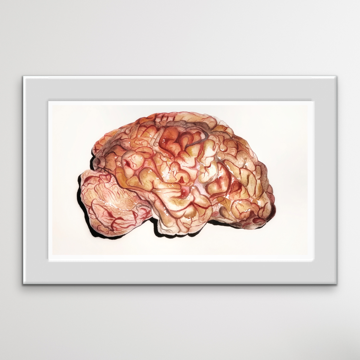 The Brain