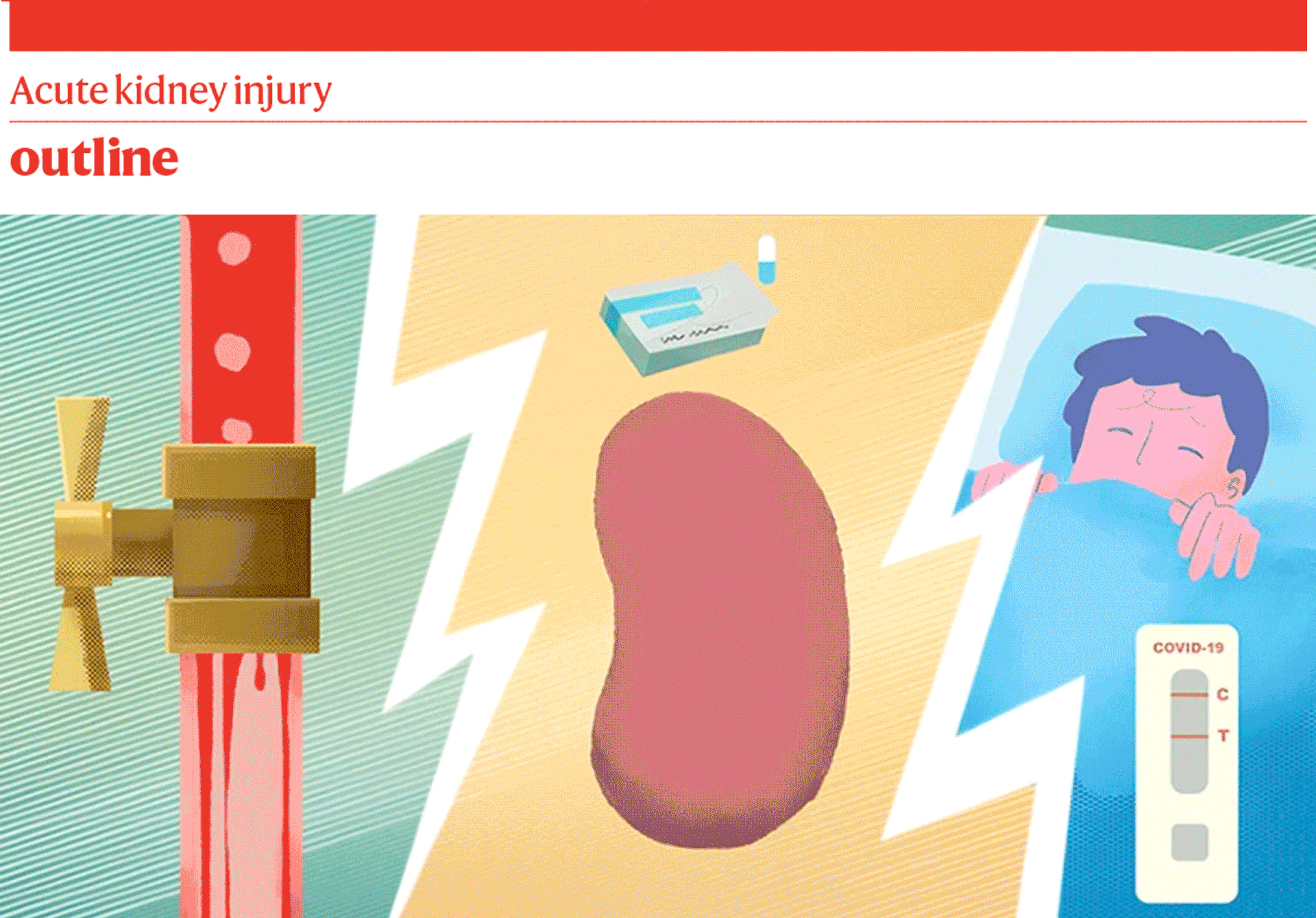 Graphics developed for Nature Outline on kidney injury, causes and treatments