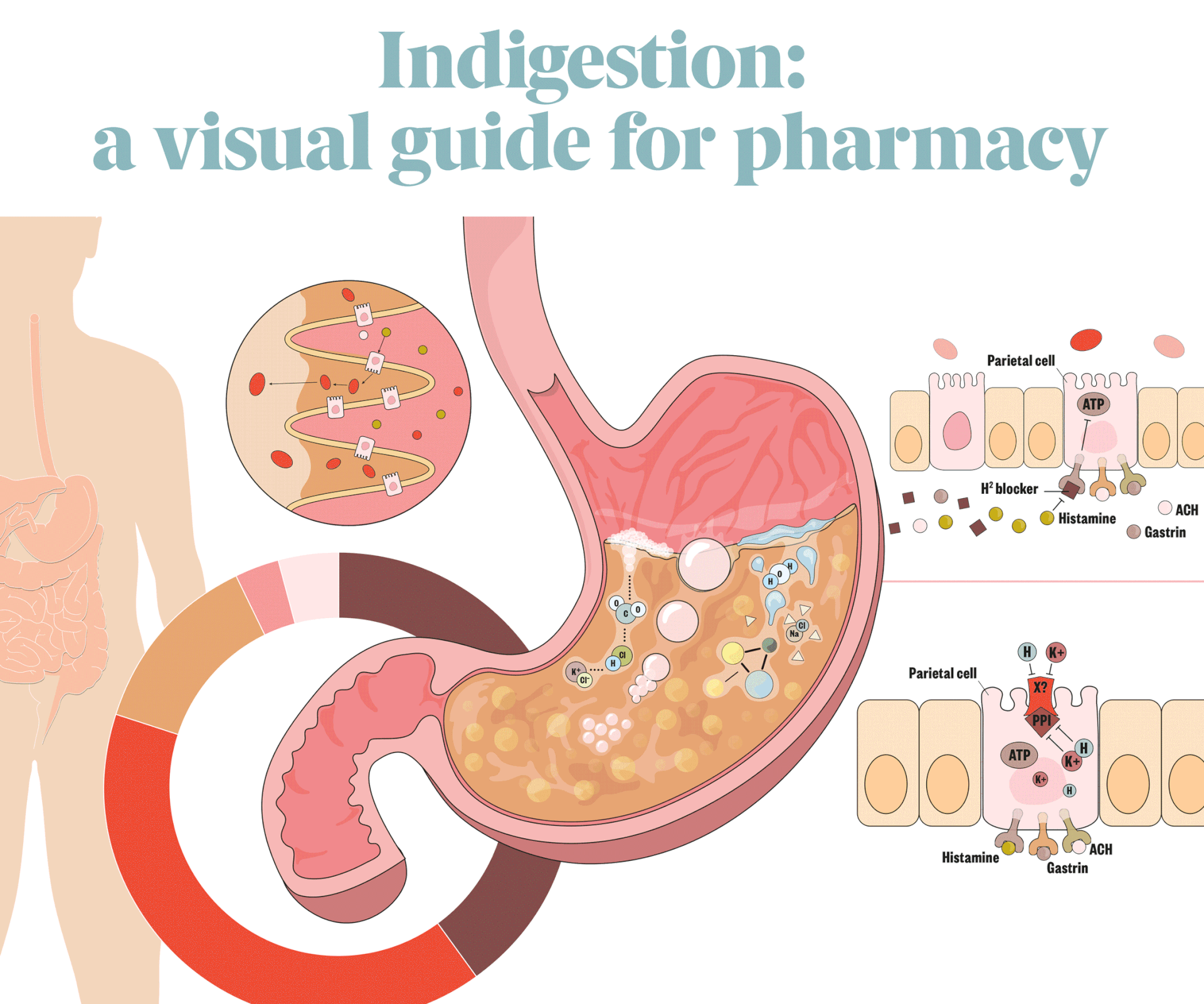 An infographic article on indigestion for the Royal Pharmaceutical Society