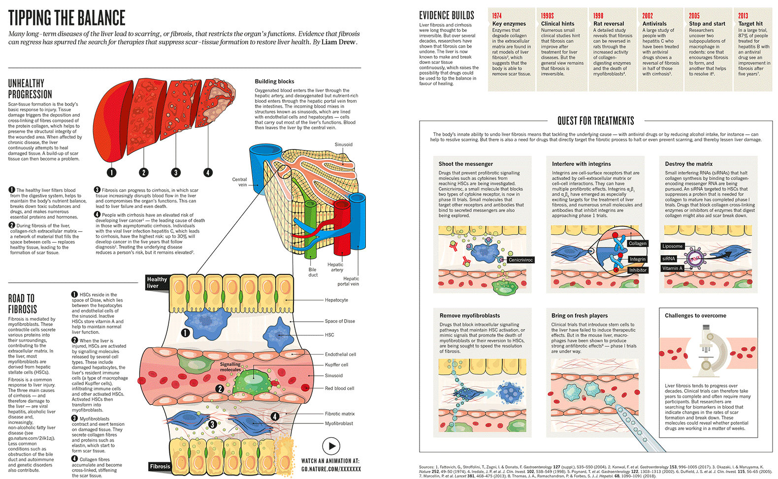 Special graphic feature on liver fibrosis, for a Nature magazine supplement.