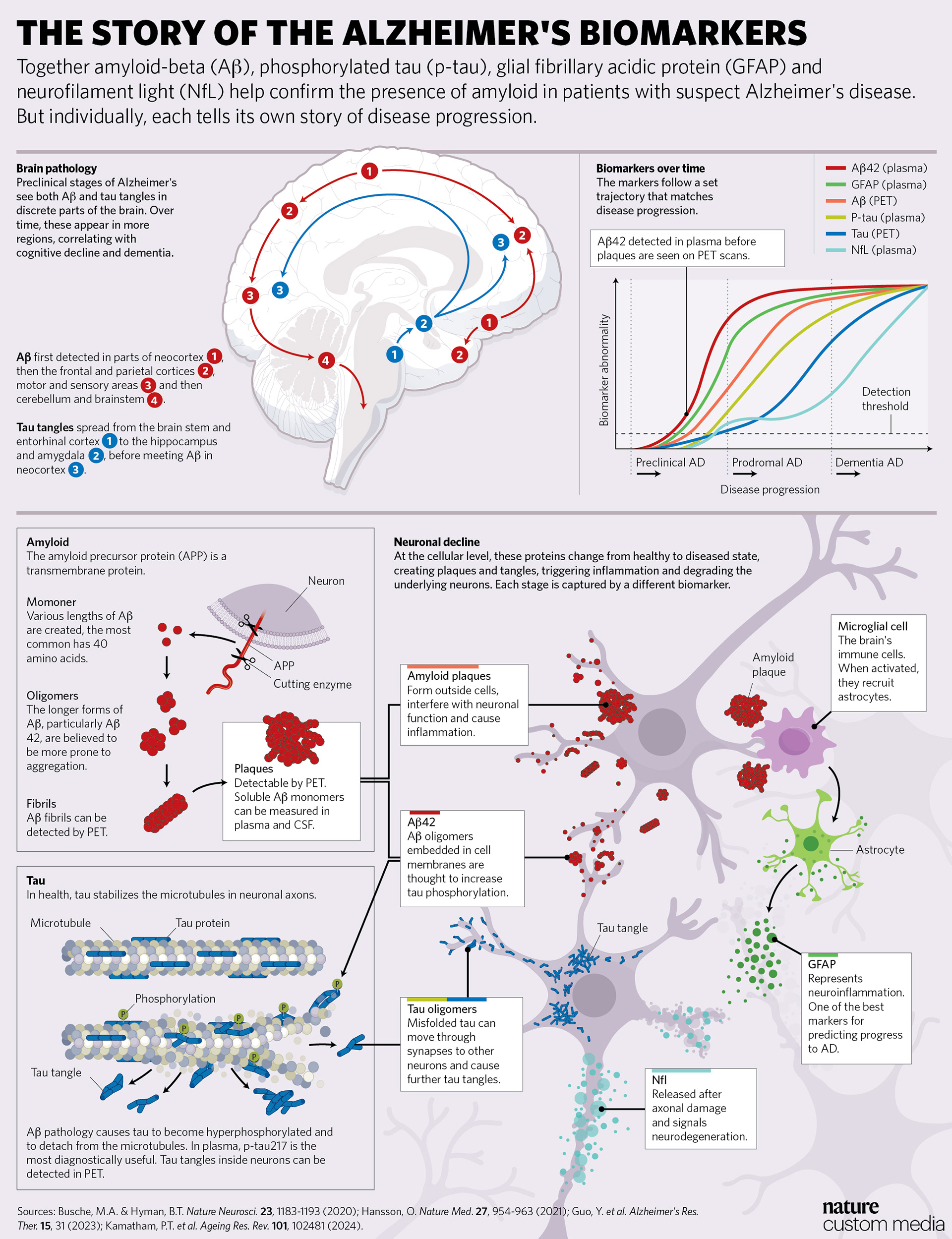 "What individual biomarkers reveal about Alzheimer’s pathology", a full-page infograpghic for Lucent Diagnostics, published on nature.com