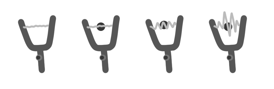 Slingshot sprite