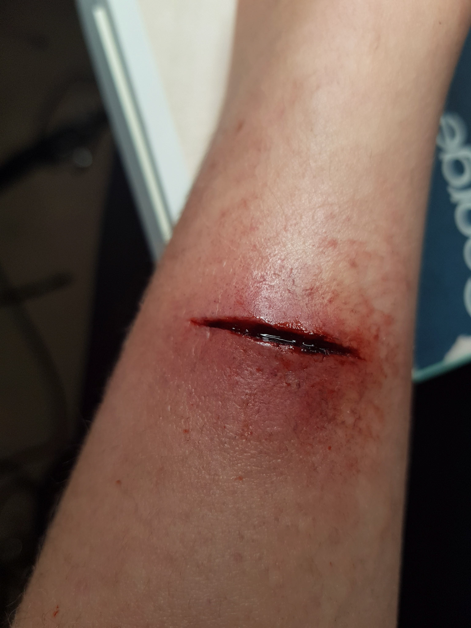 a scar wax cut