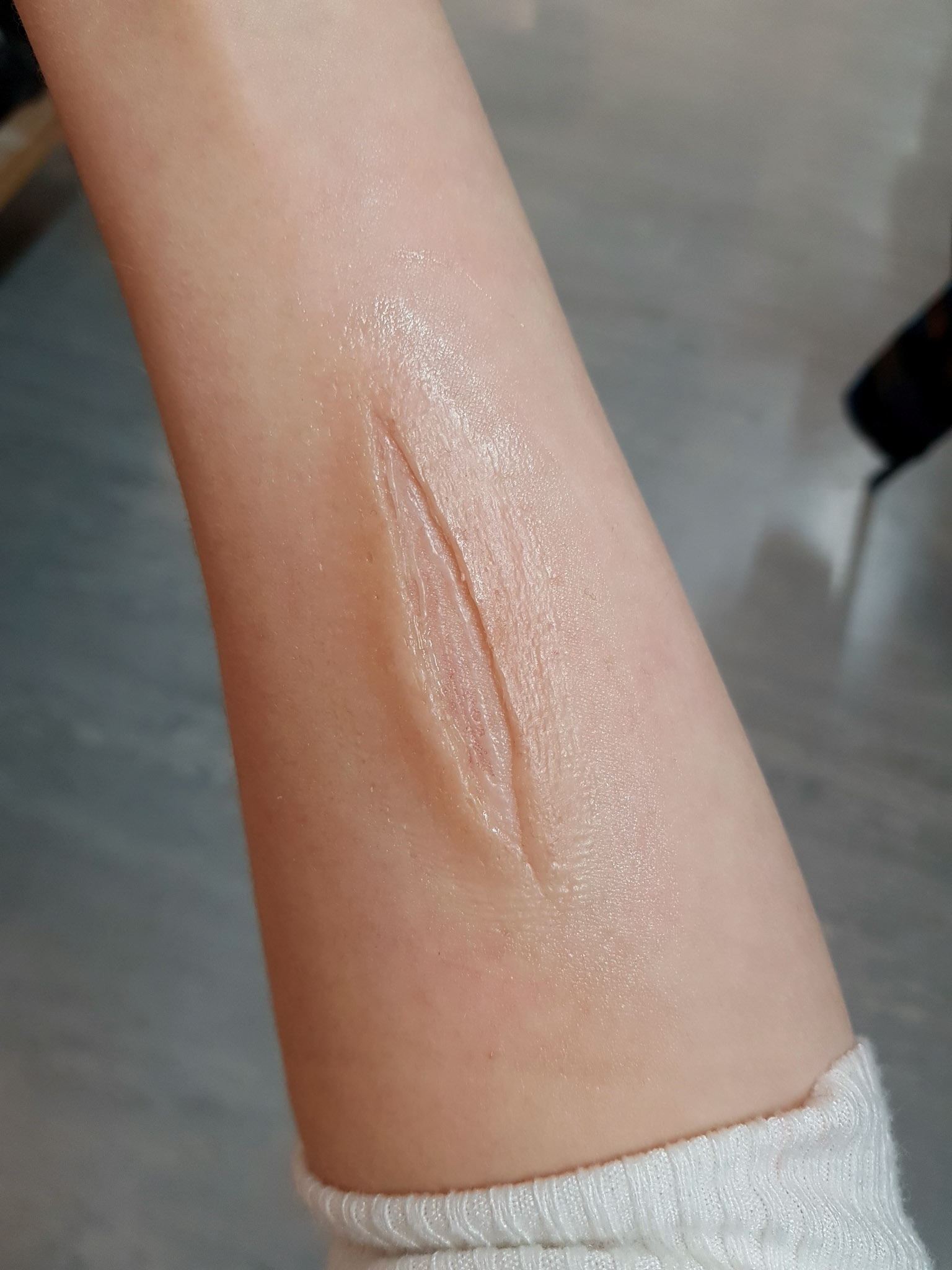 a pro-bondo pre-painted transfer