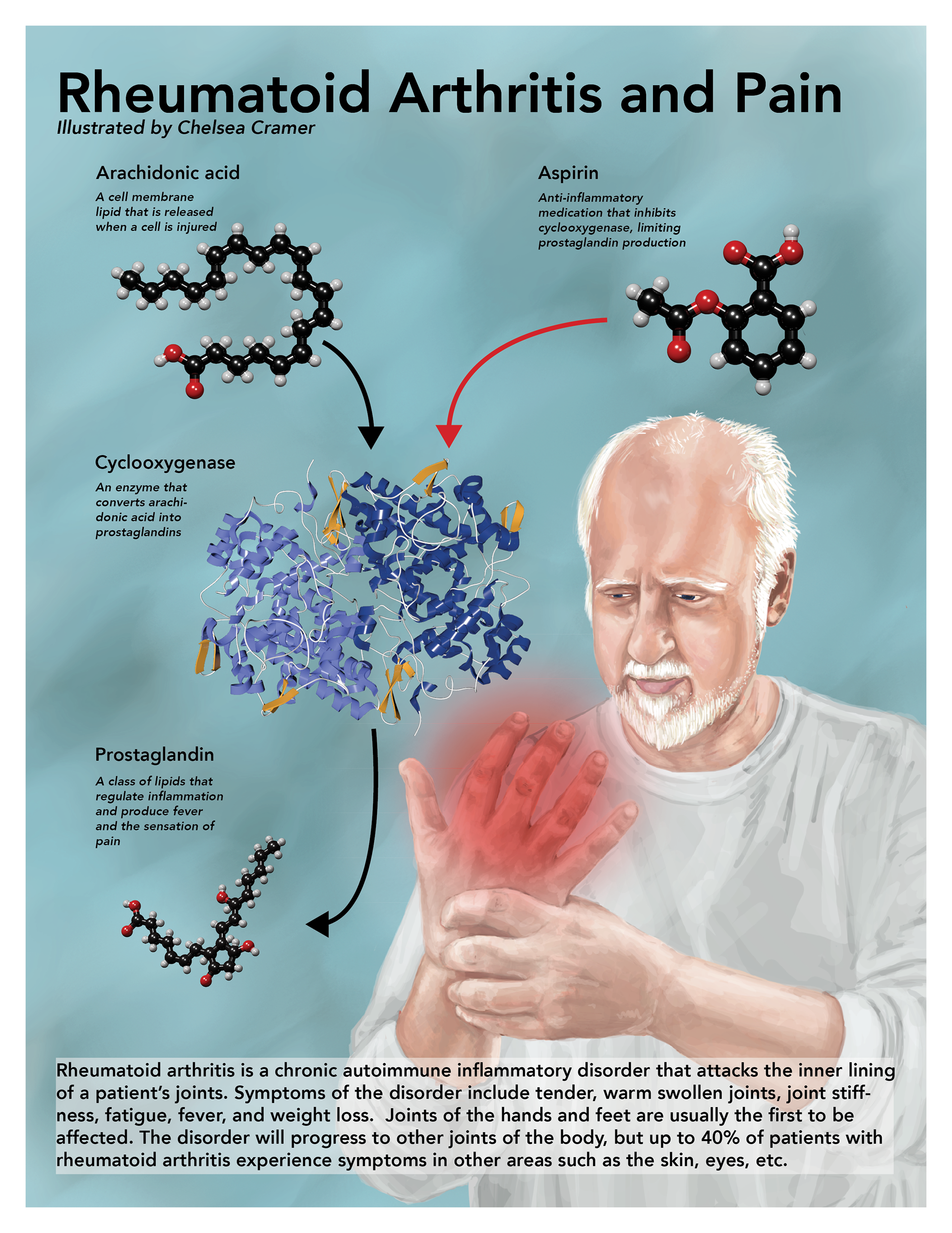 Rheumatoid Arthritis and Pain - Created in Photoshop, Models from PDB, Chimera, and then Cinema 4D, Poster created in Adobe InDesign - Spring 2018