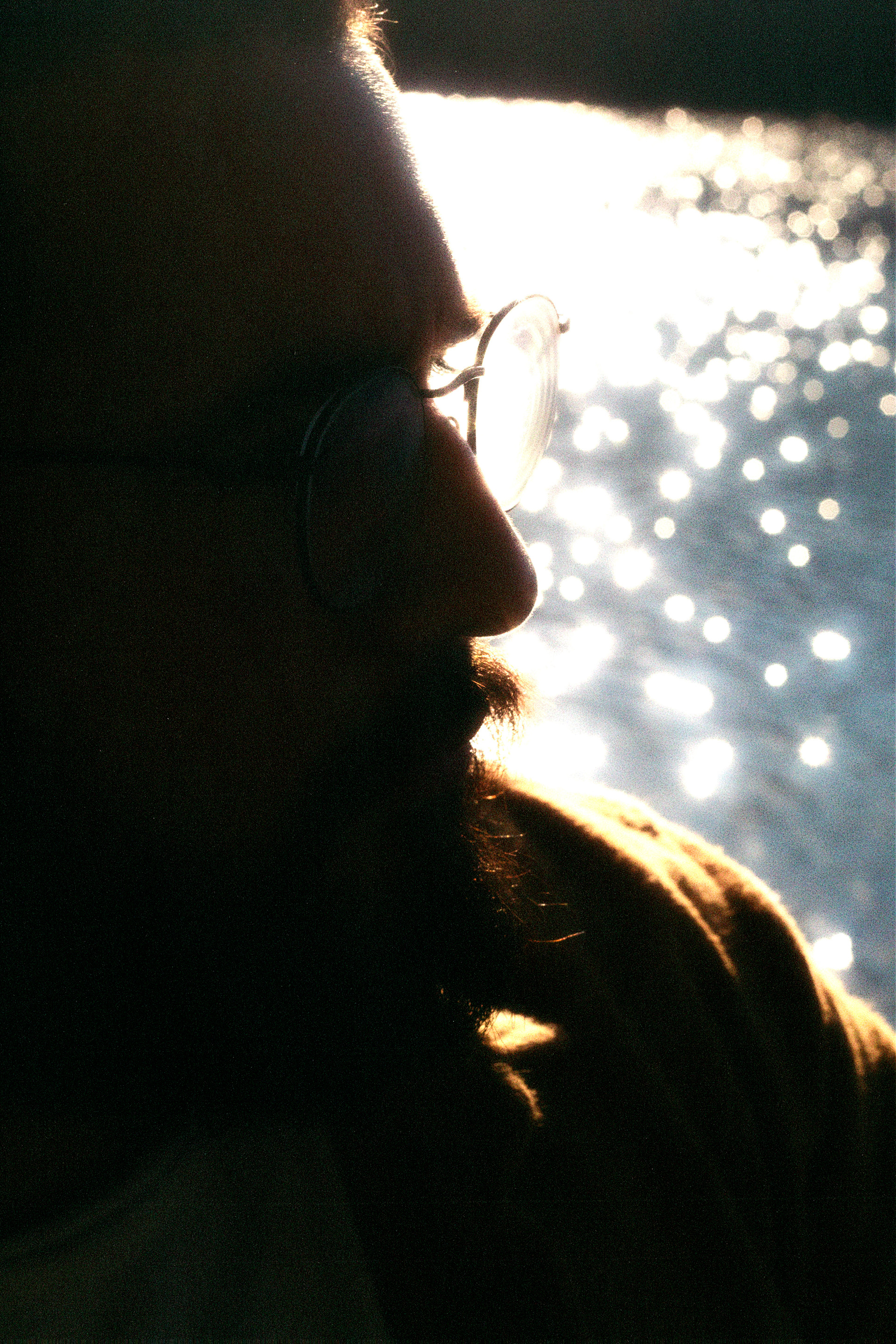 Sun on skin_2