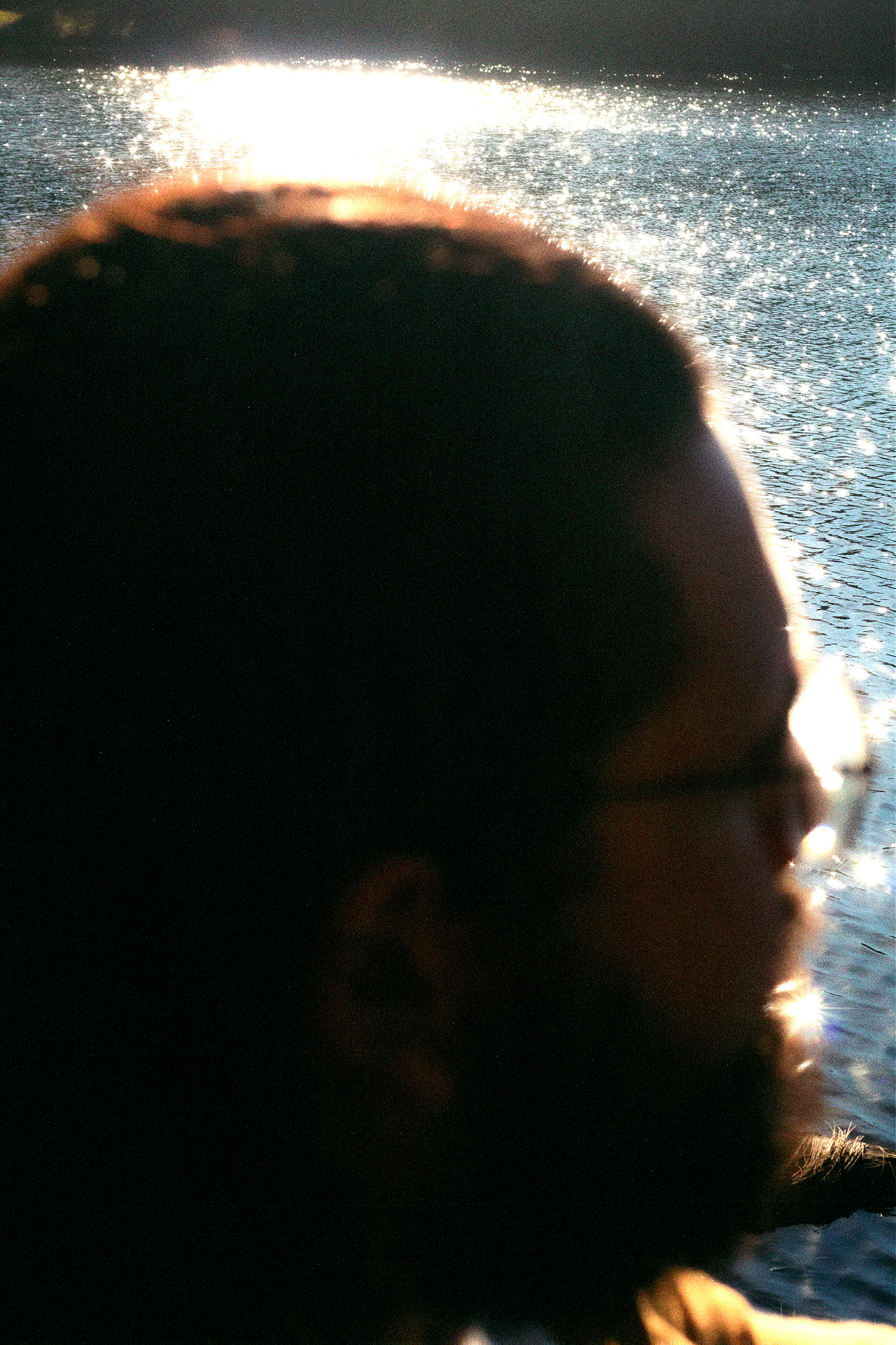 Sun on skin_1