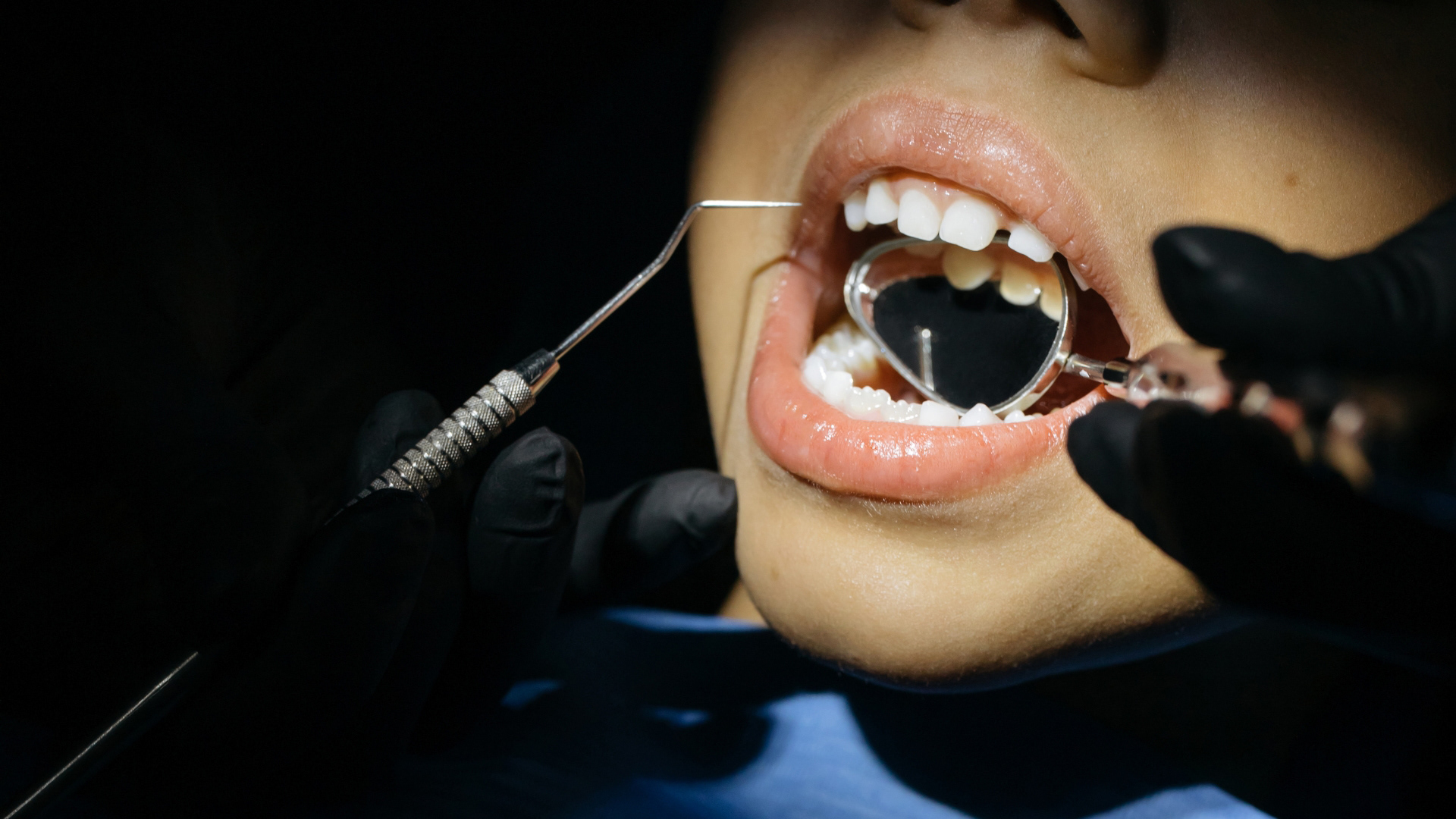 Dental checkup for a child at The Dental Lounge, Indore, Madhya Pradesh, India, conducted by Dr. Nidhi Vyas. The image captures a young patient receiving a comprehensive dental examination to ensure optimal oral health, emphasizing the clinic's child-friendly approach and commitment to preventative dental care in Indore.