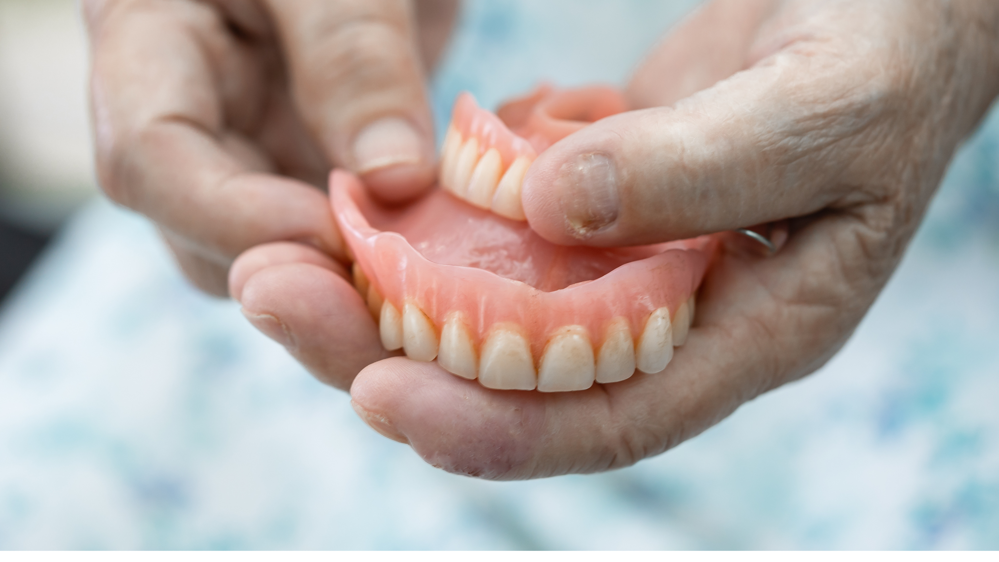 Custom-designed dentures available at The Dental Lounge, Indore, Madhya Pradesh, India, expertly fitted by Dr. Nidhi Vyas to replace missing teeth, restore smiles, and improve oral functionality with precision and care.