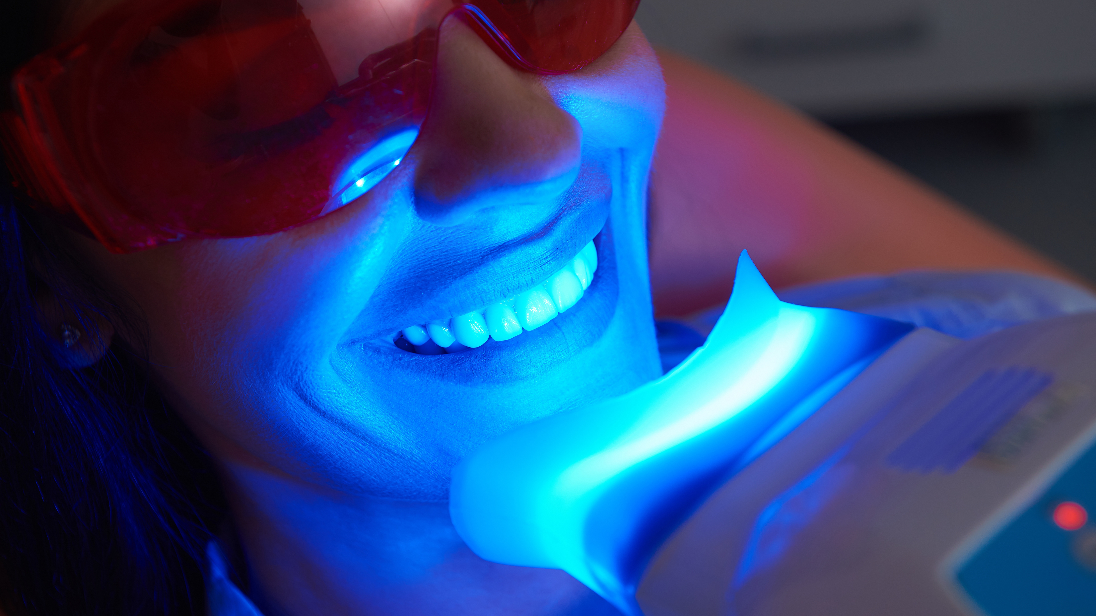 Before and after teeth whitening treatment at The Dental Lounge in Indore, Madhya Pradesh, India, showcasing a significant improvement in tooth brightness and color, under the expert care of Dr. Nidhi Vyas.
