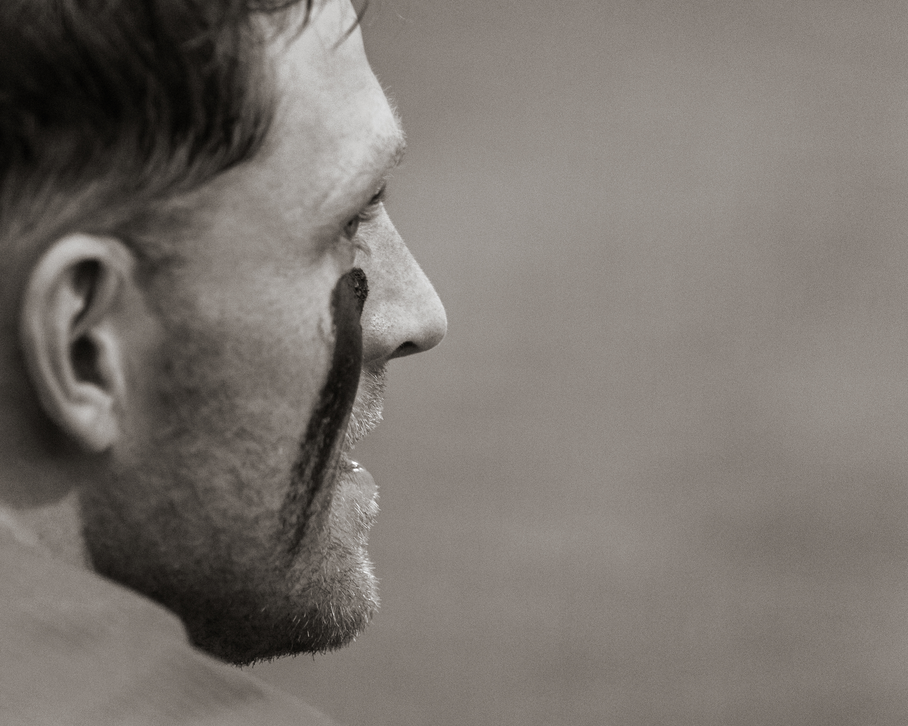 Trevor McCollum watches the game go on in the dugout