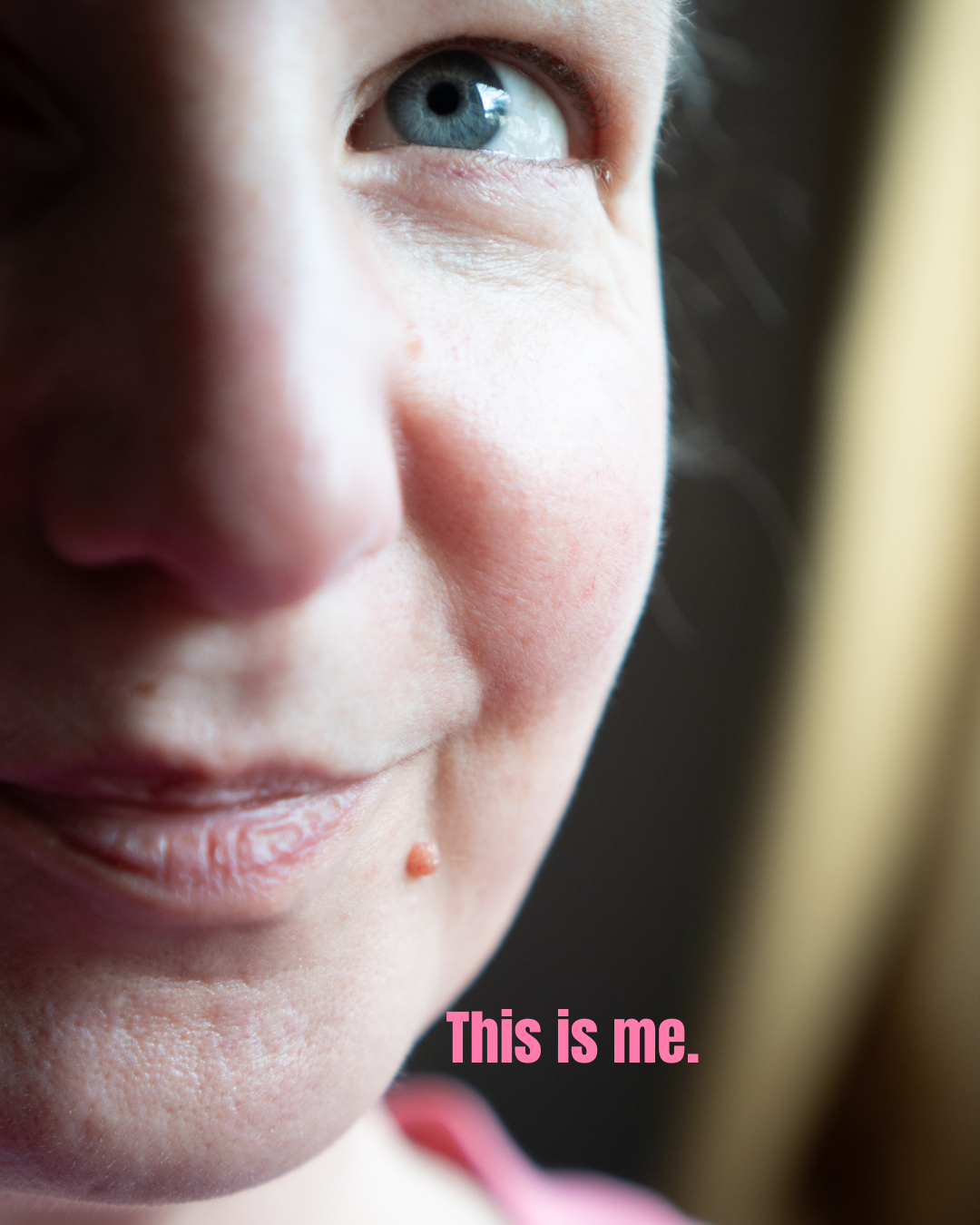 A close up of a white woman's face showing her nose, smiling mouth, chin, and one blue eye with window light reflected in it. The overlaid text reads "This is Me".