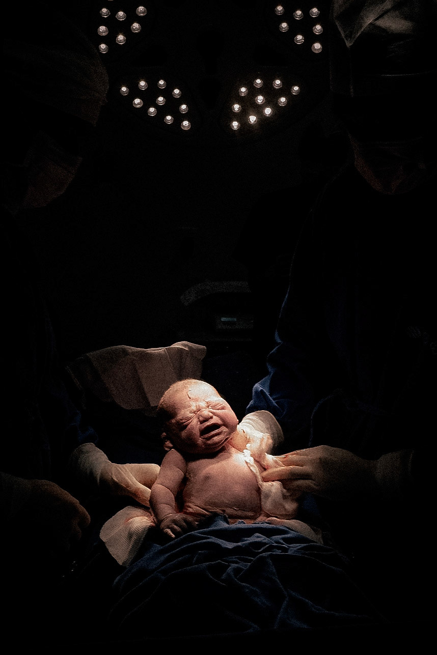 Nascimento Ben - Clínica Santa Helena - Maternidade Florianópolis - Parto - Foto e Filme