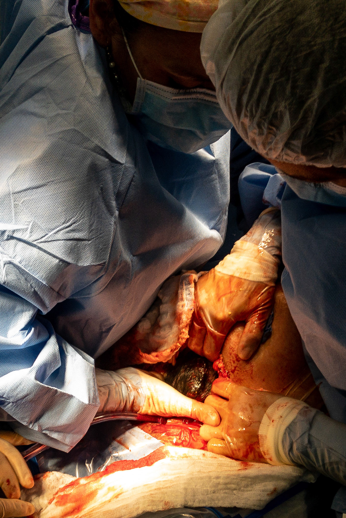 Julián Bernal Gómez  Nace el 14/12/18 a las 16:33 horas de 3690 g 54 cm Apgar 9/9, capurro 40 semanas  Padres: Thania Gómez Arce
Julio César Bernal Salguero