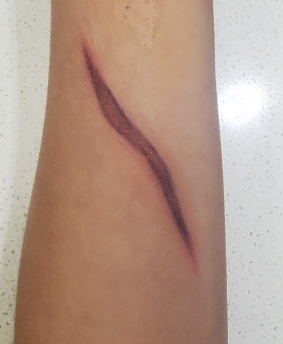 Painted Scar