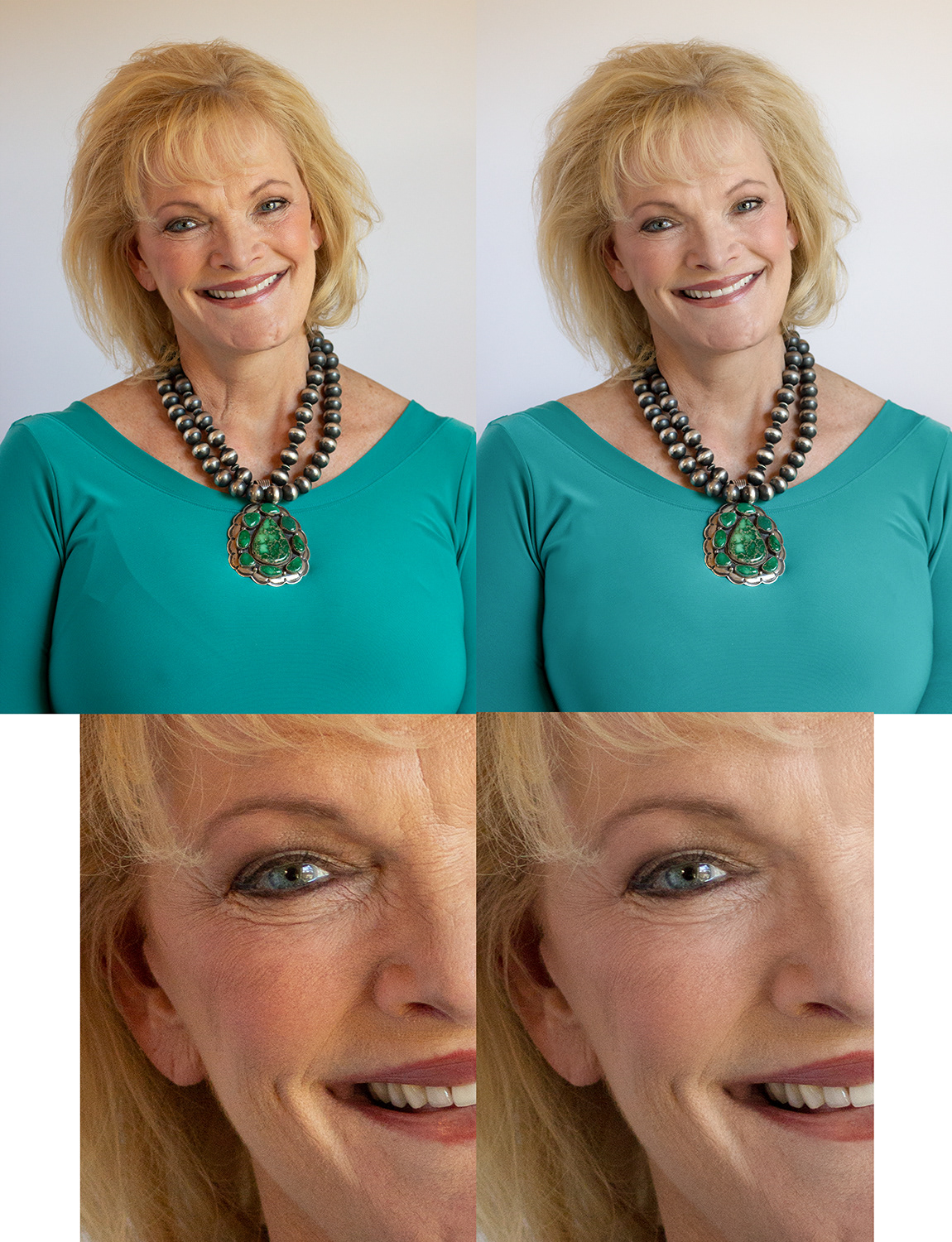 Beauty Edit - Color and skin texture correction.