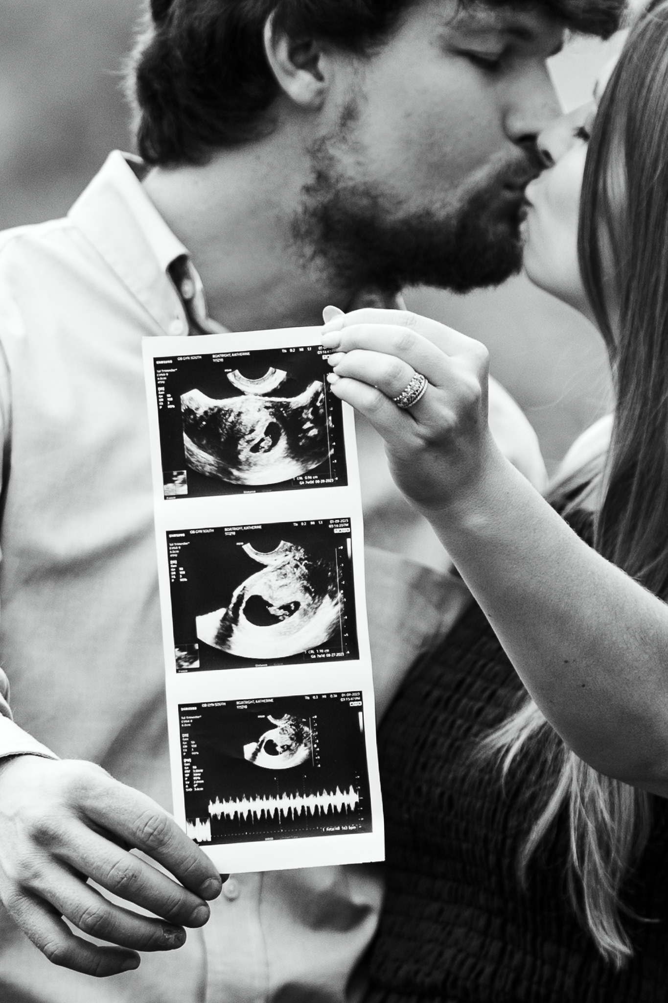 Black and White of couple holding sonogram