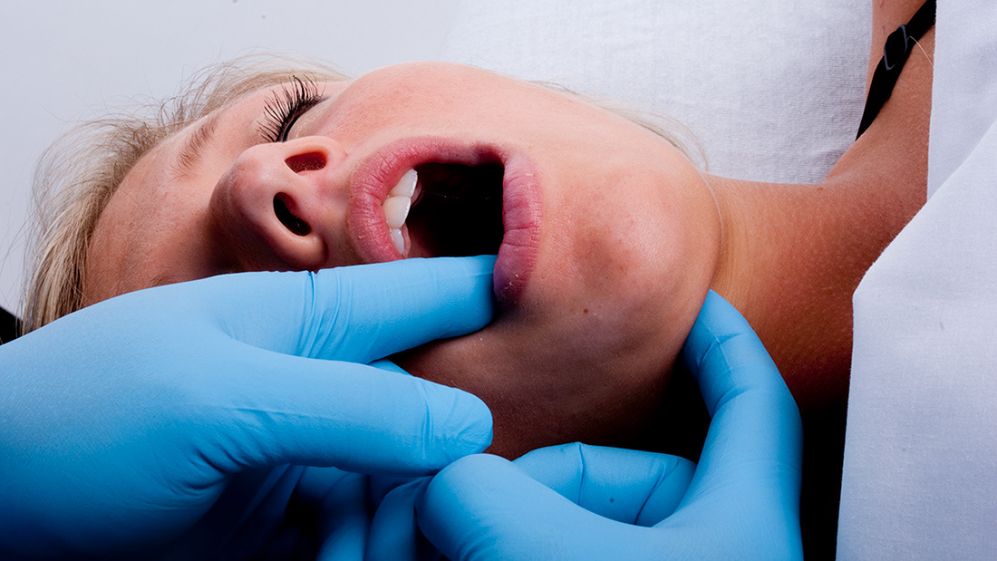 Intraoral Treatment Photo