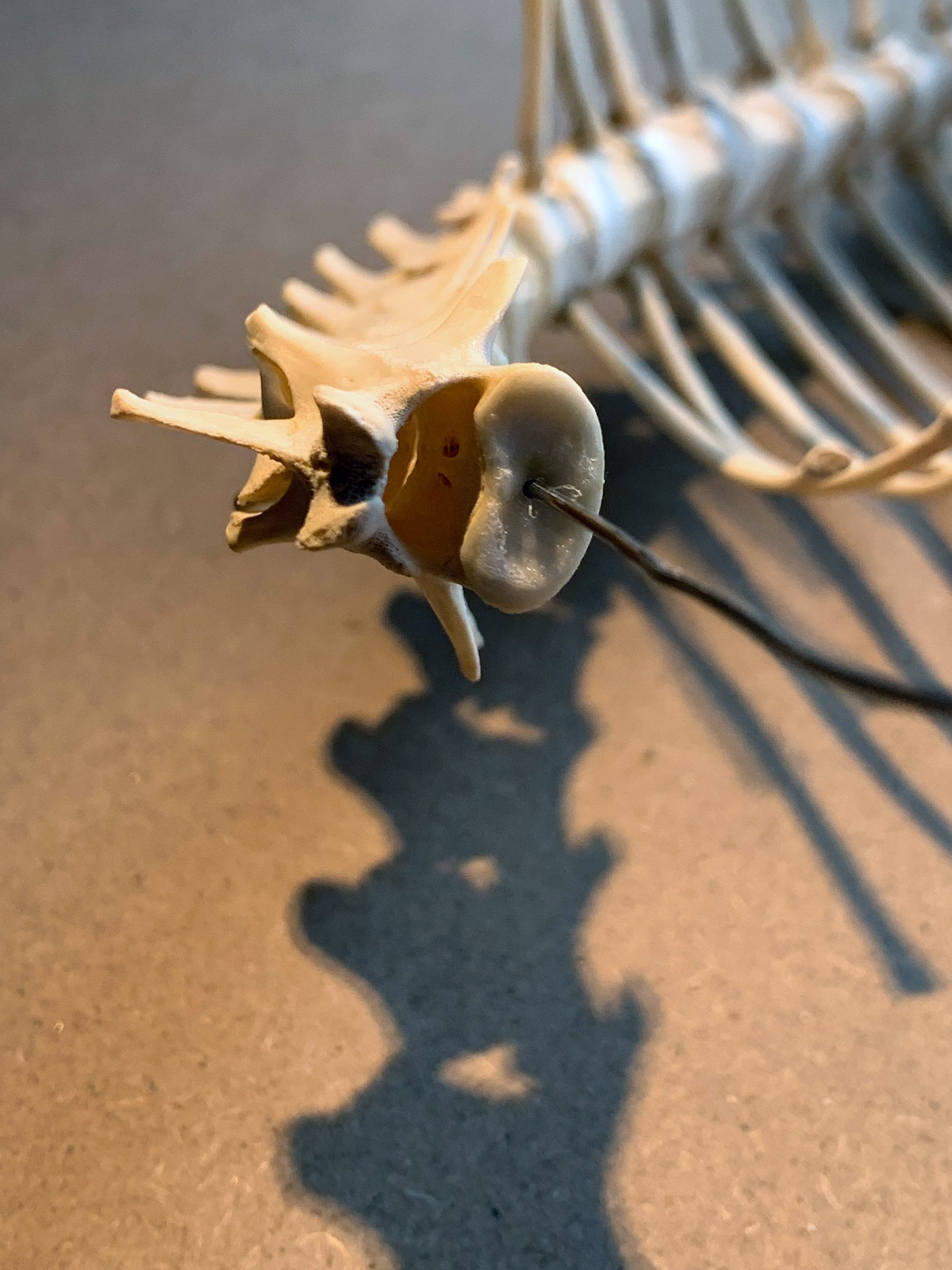 Spine work