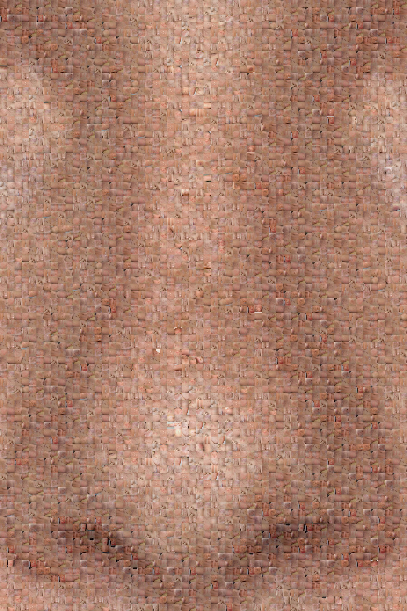 FRECKLES