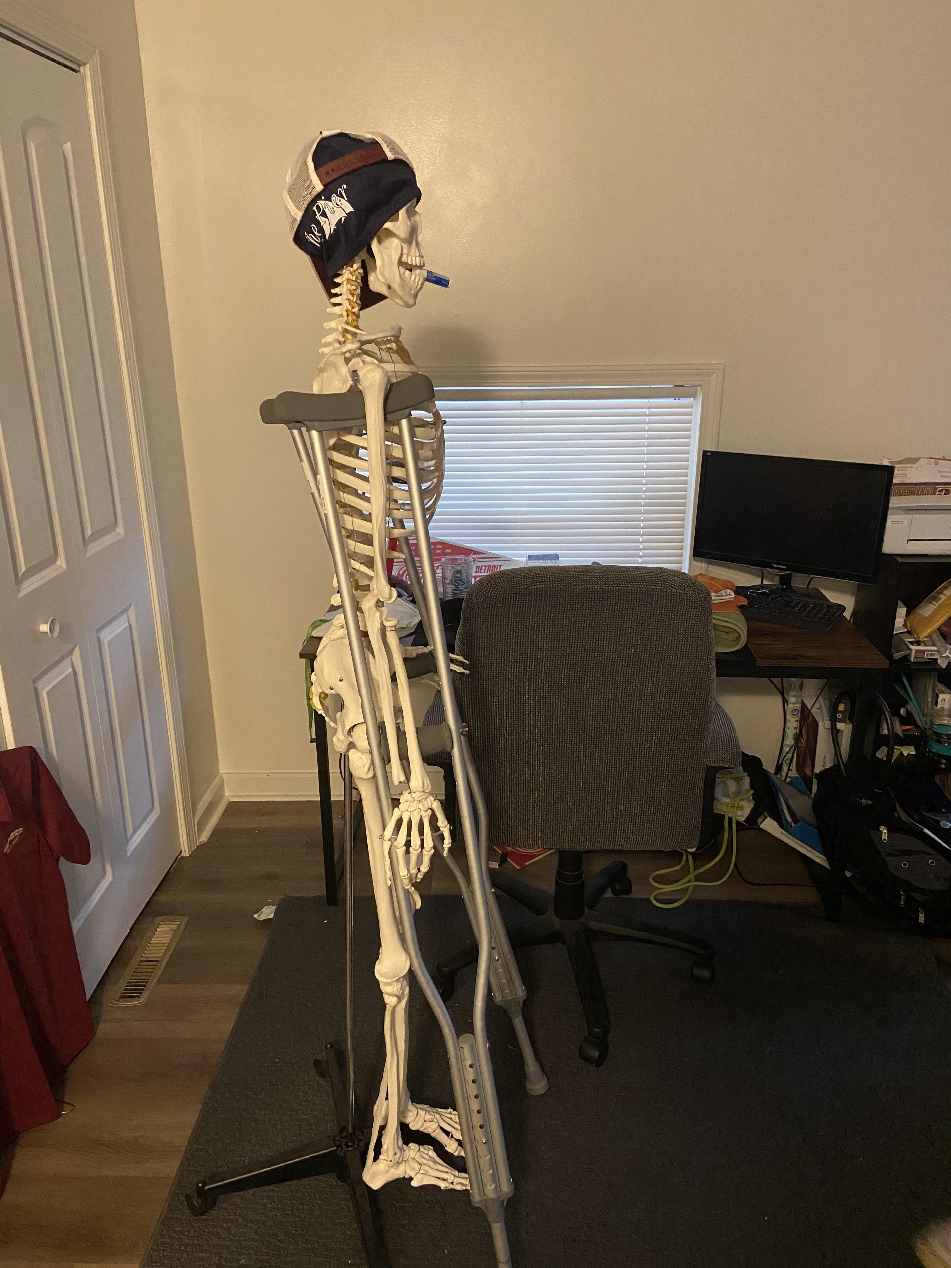 Skeleton Recovering from Ruptured Achilles Tendon