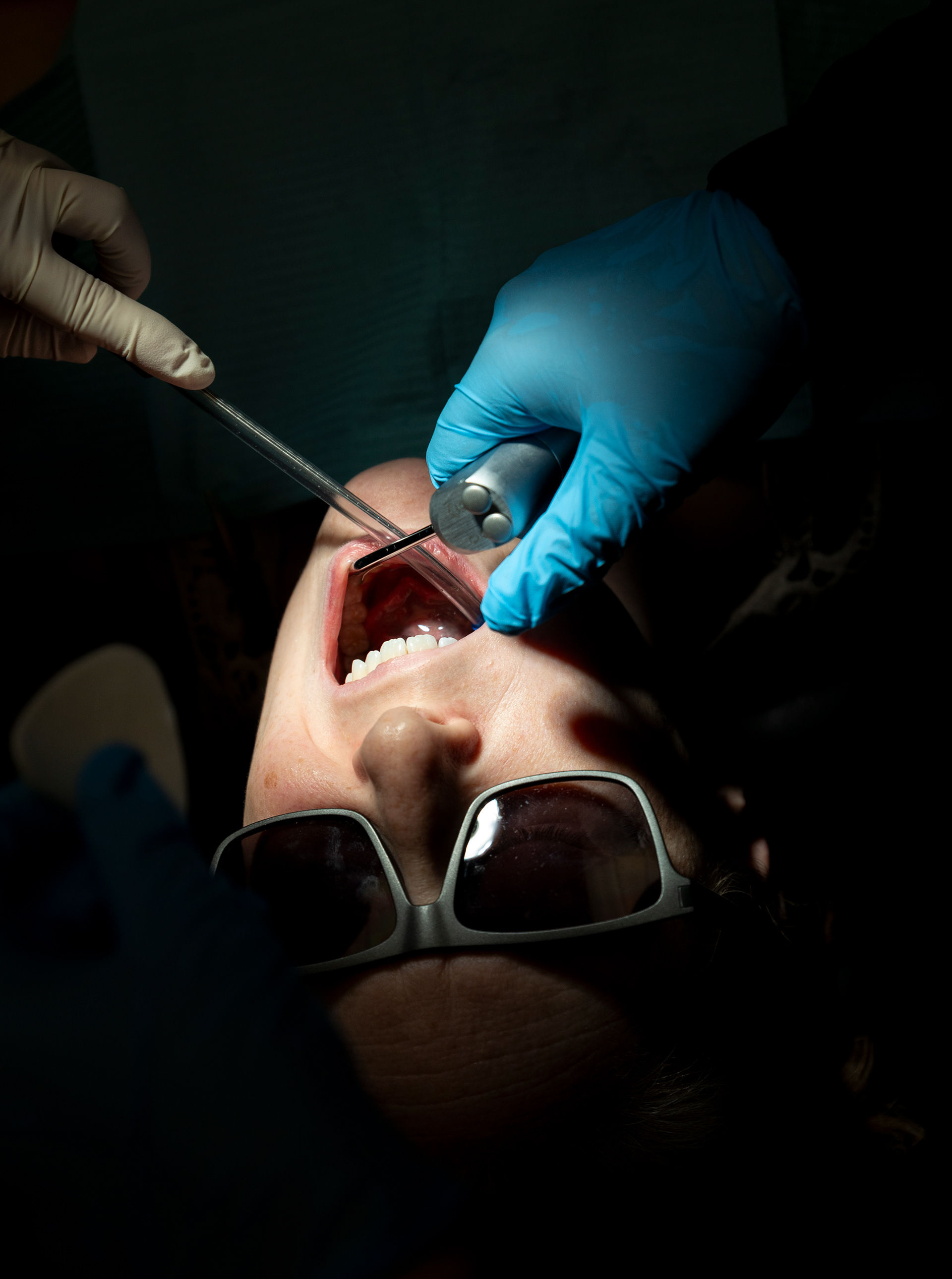 Michelle Ashby has sealants placed in her teeth at Bluegrass Dental in Evansville, on Tuesday, June 18, 2024.