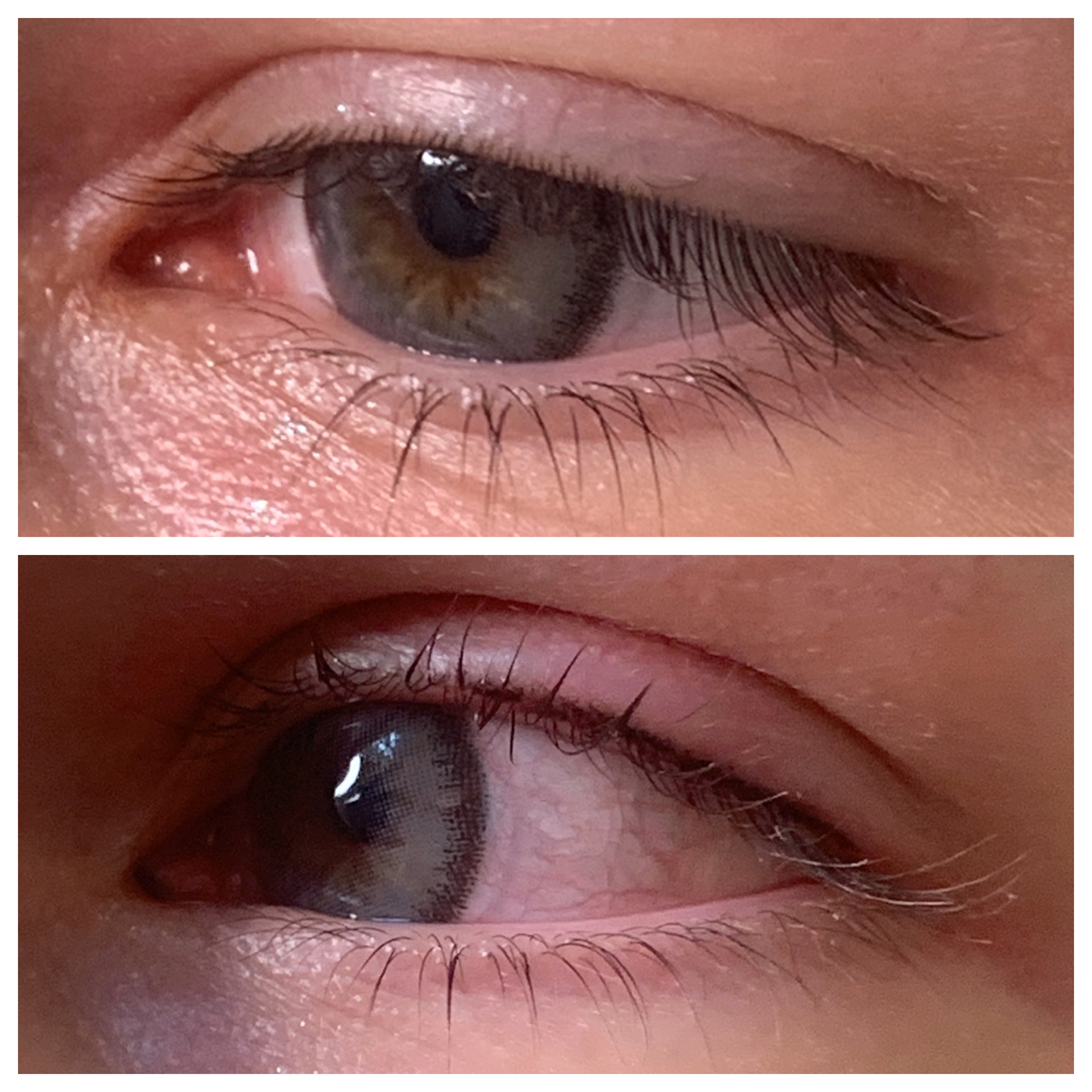 Lash Lift
