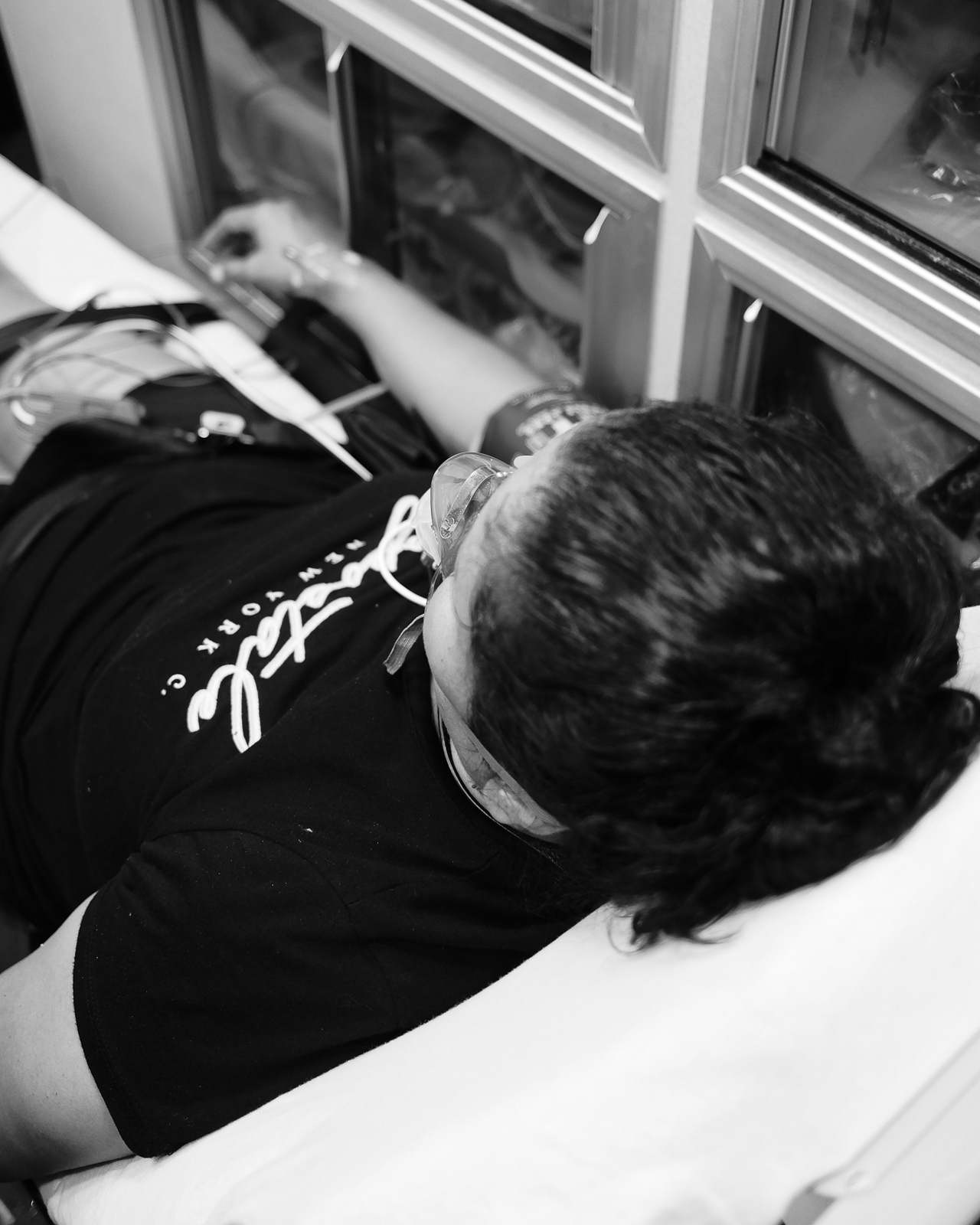 Call No. 5 Nature of Illness: Breathing problems. Mental Status: Good, no abnormalities. Chief Complaint: Shortness of breath- x4 days onset, back pain-x3 days onset-8/10 to mid back, pressure, non-radiating and not new. Hx: Bronchitiis. Signs/Symptoms: difficulty catching breath, anxiety, rhonchi wheezing. Airway: Good, no abnormalities. Breathing: abnormal, respiratory rate-28, rapid, SPO2 93%. Circulation: Good, no abnormalities. Assessment: Lung sounds, chest assessment, back assessment, vital signs, heart rhythm-NSR, 12 lead- right axis present, blood glucose-179 mg/dl. Treatment: IV access, O2, Albuterol, Atrovent and Solu medrol. Differential diagnosis: Bronchitis. Rule out: Heart arrhythmia, Heart failure, Anaphylaxis. En-route: Monitor mental status, ABC’s, reassess vital signs and notify hospital. Repeat until we arrive at the hospital.