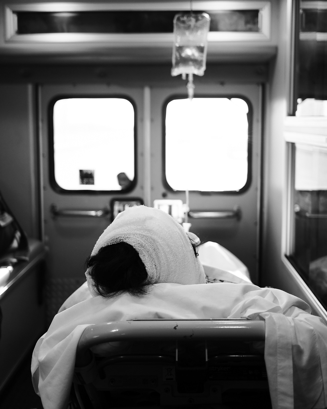 Call No. 4 Mechanism of injury/Nature of Call: Syncope/Fall. Mental Status: Good, no abnormalities. Chief Complaint: : Left Head pain/ Pelvic pain. Signs/Symptoms: Head injury- hematoma present-actively bleeding-positive LOC, Pelvic-tender, no obvious deformities. Hx: No blood thinner medication, occurring falls, DM2, HTN. Airway: Good, no abnormalities. Breathing: Good, no abnormalities. Circulation: Good, no abnormalities. Assessment: Head-to-toe assessment, pupil assessment-4mm-PERRL, stroke assessment-negative, spinal cord injury assessment-negative , lung sounds-clear, vital signs, heart rhythm-NSR, 12 lead-prolong QT, glucose assessment-187mg/dl, skin turgor assessment- positive. Treatment: C collar, bleeding control-multiple bandages, IV access, Pain management-Morphine/Zofran, IV fluids. Rule out: Traumatic brain injury, seizures, sepsis, stroke, heart arrhythmia, heart failure, hypoglycemia. En-route: Monitor mental status, ABC’s, reassess vital signs, and notify hospital. Repeat until we arrive at the hospital.