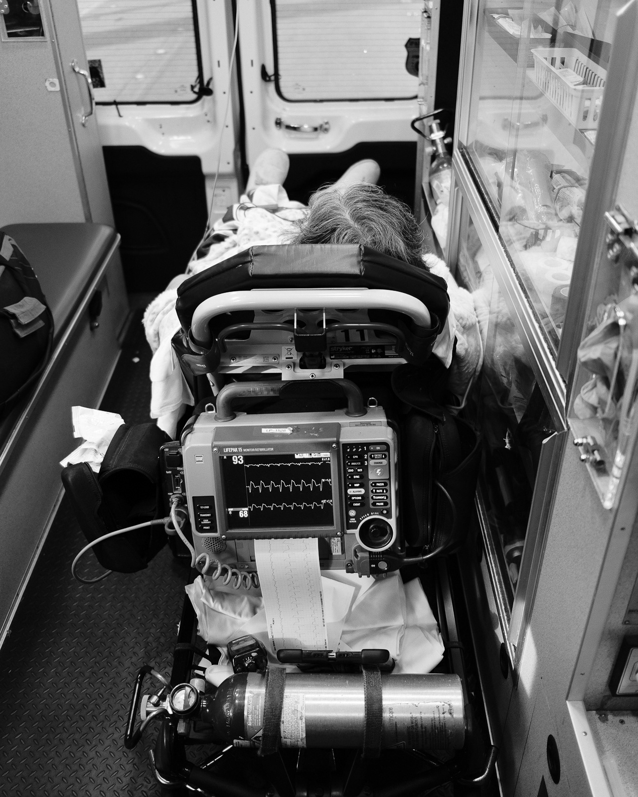Call No. 4 Nature of Call: Non-Traumatic Chest pain. Mental Status: Good, no abnormalities. Chief Complaint: Chest pain-onset 2 weeks, 10/10 constant pressure, non radiating. Signs/Symptoms: GBW, SOB and new onset of pedal edema. Airway: Good, no abnormalities. Breathing: Respirations at 24, no other abnormalities. Circulation: Cyanotic lips present, no other abnormalities. Assessment: Chest assessment, lung sounds, vital signs, cardiac rhythm, glucose and 12 lead-STEMI-V1 (2.72mm) V2 (3.57mm), Left Bundle Branch Block, Left Axis Deviation, QRS 0.16s. Treatment: Aspirin, Nitro, IV access and transport-lights and sirens. Differential diagnosis: Septle MI-LAD occlusion. En-route: Monitor ABC’s, reassess vital signs, continue treatment, notify hospital ASAP. Repeat until we arrive at the hospital. Patient-reports feeling better with treatment-chest pain now 4/10, lips normal and SOB subsided.