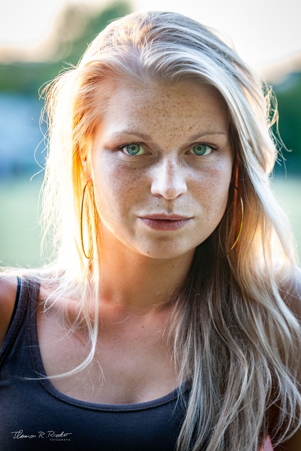 freckles