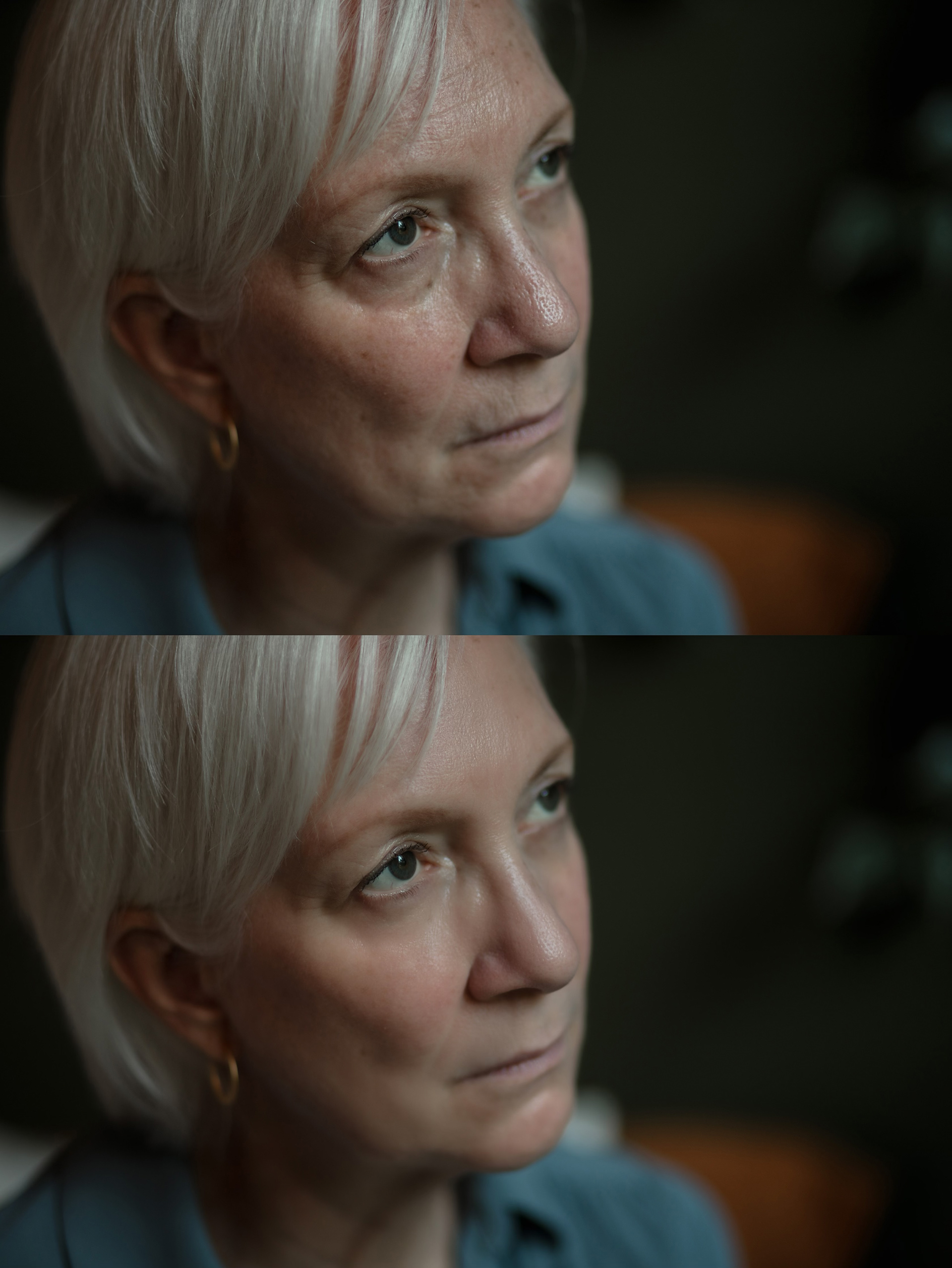 Wrinkles/Skin Texture on Mature Skin