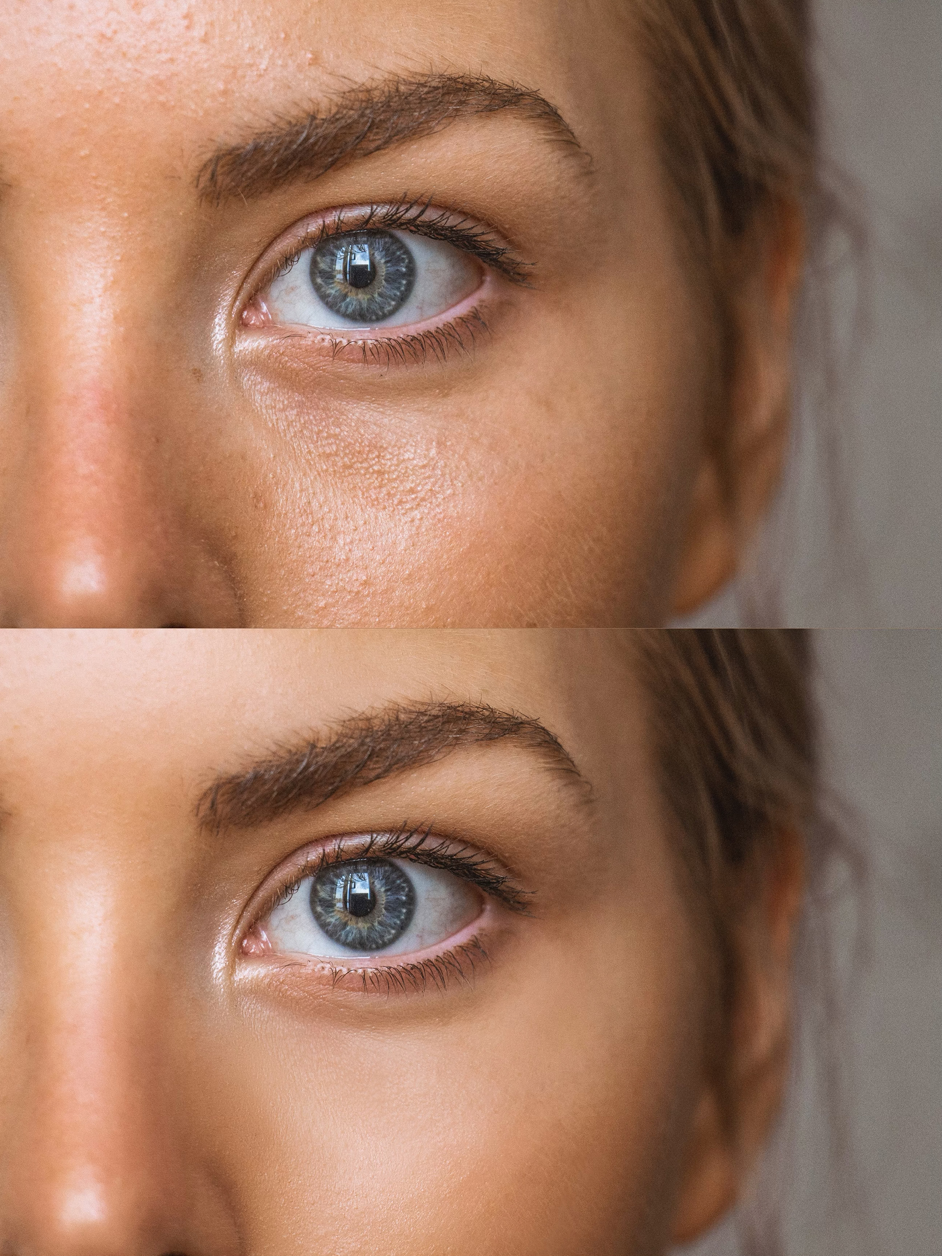 Skin Texture