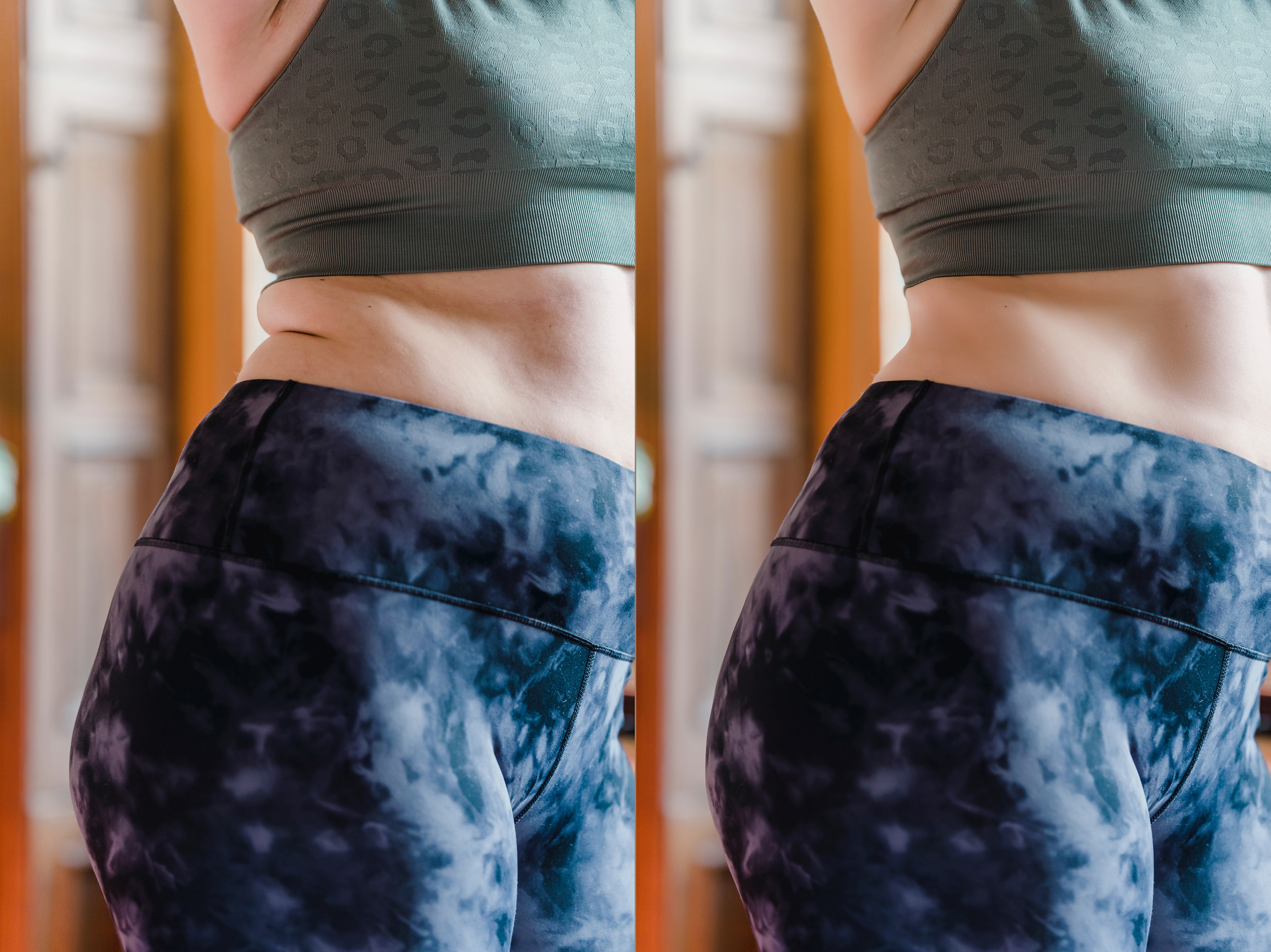 Body Reshaping