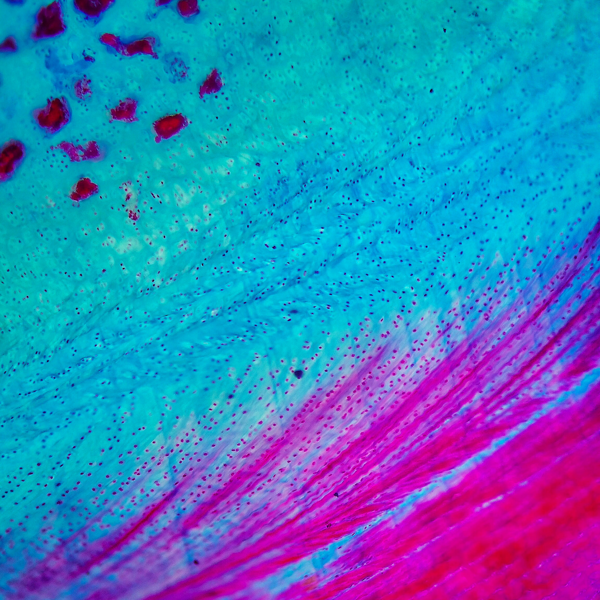 Elastic Connective Tissue x400. Masson’s trichrome.