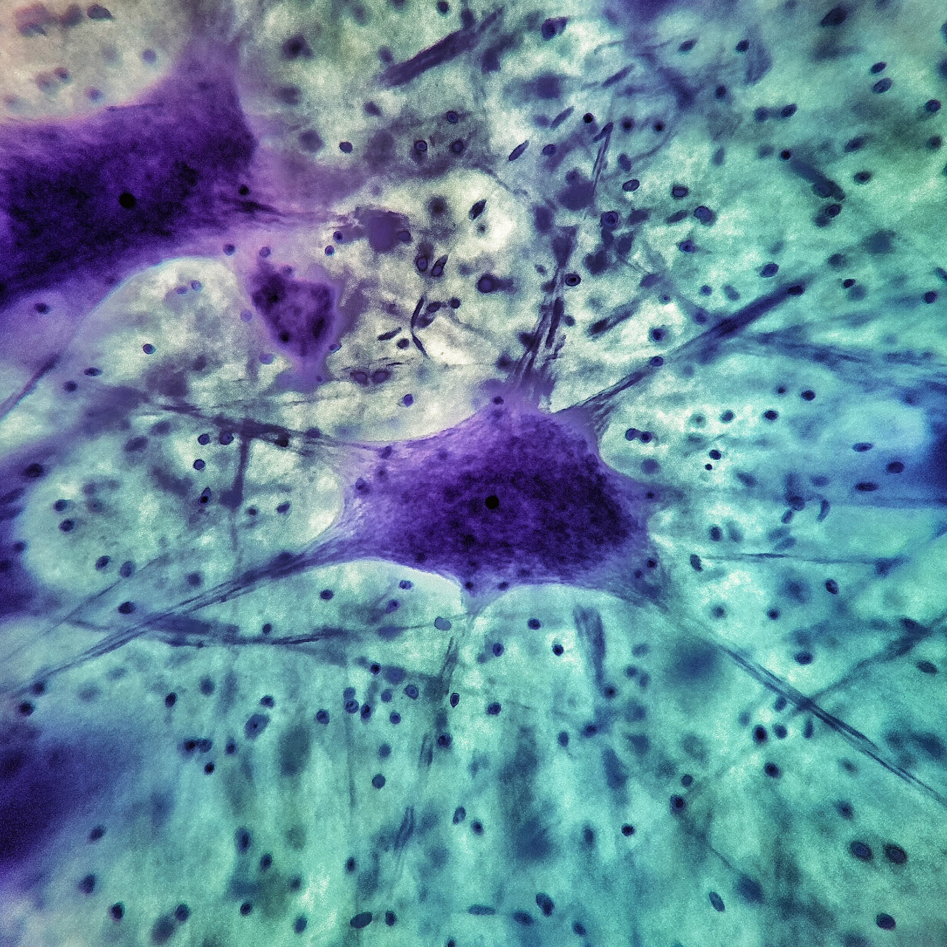 Motor Neurons x 400. Nissl stain.