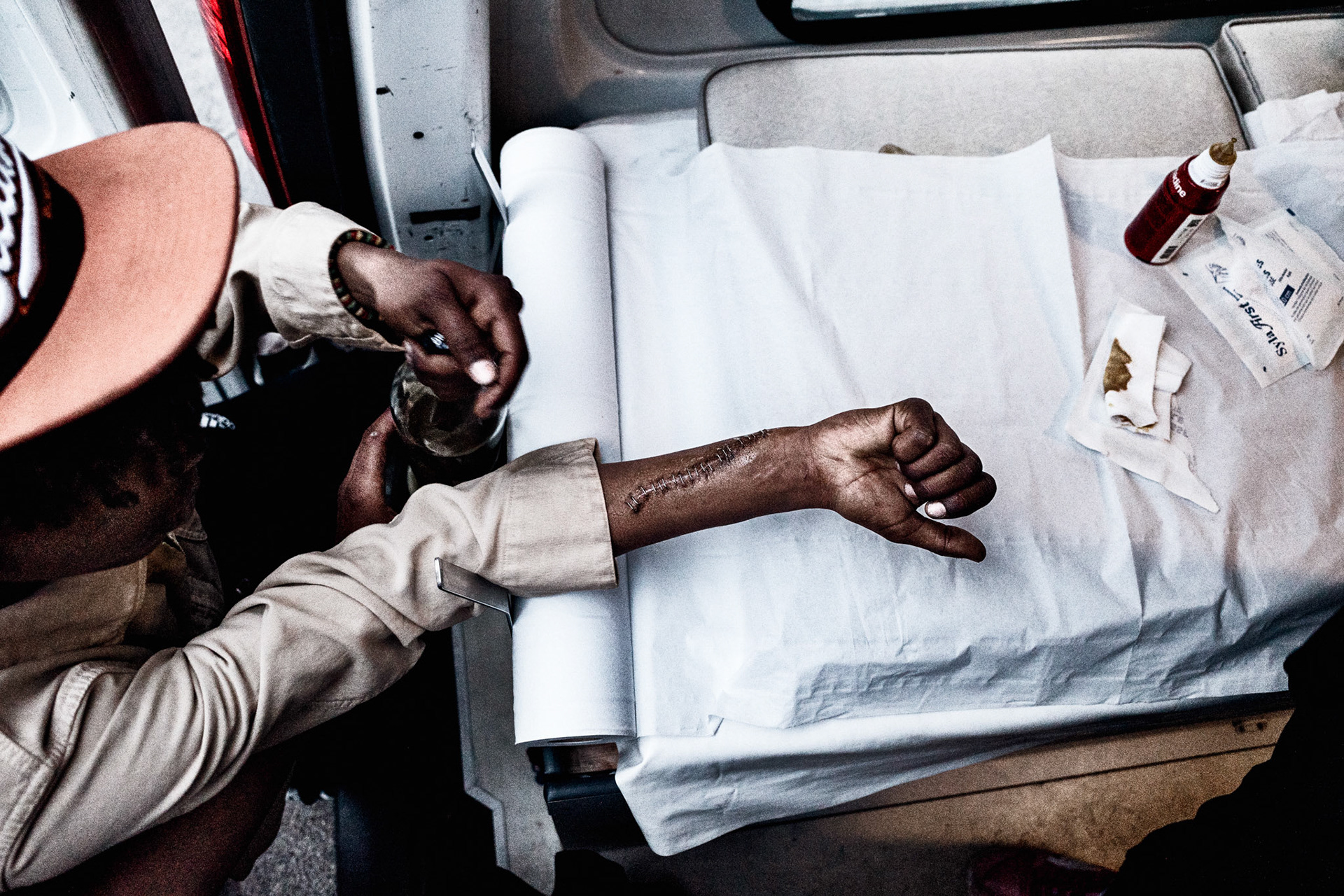 Finally, after a long time A., a young Somali is persuaded to have his 'do-it-yourself' stitches removed by the medical staff of the Medici del Mondo mobile clinic. The wound was caused by a broken bottle during an attack.
