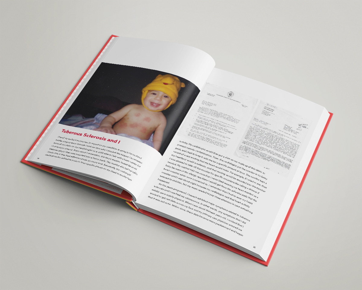 "Tuberous Sclerosis and I" Spread