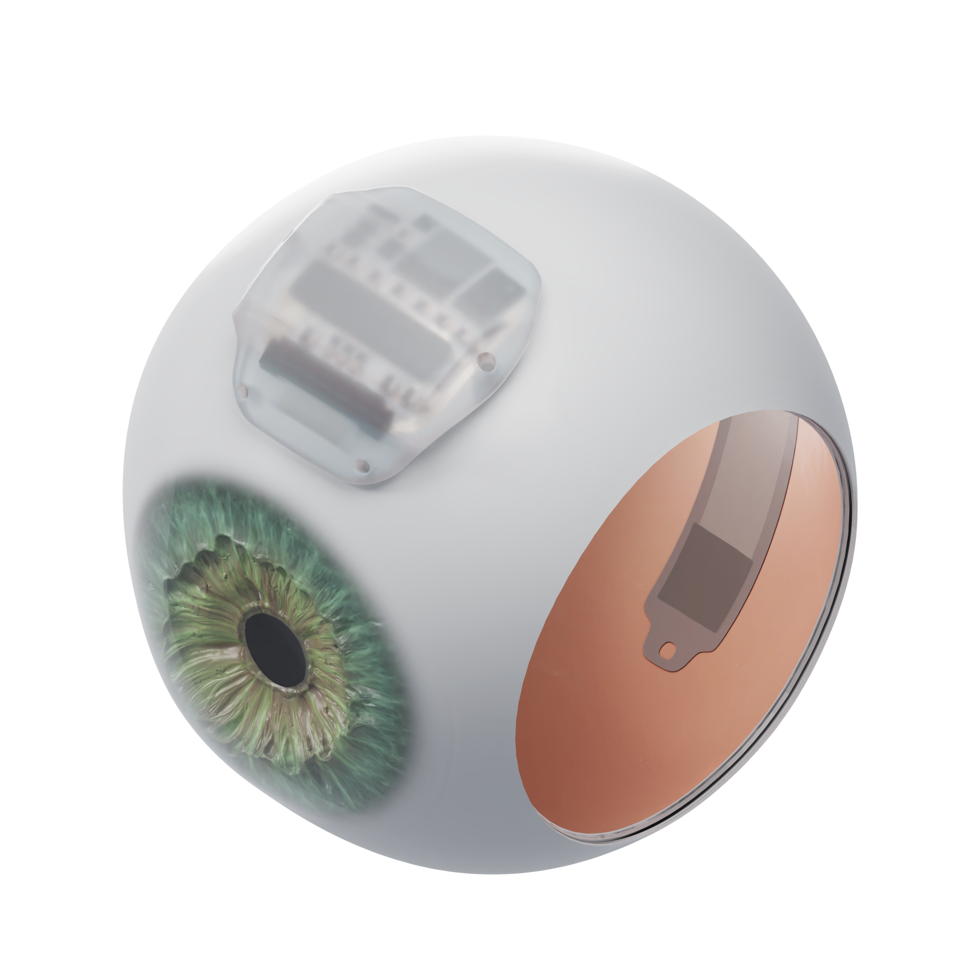STEP 3 -The display film is affixed to the retina to hold it in place