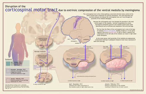 Neuroanatomy