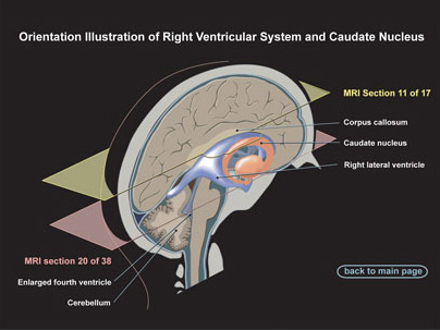 Medical legal brain illustration