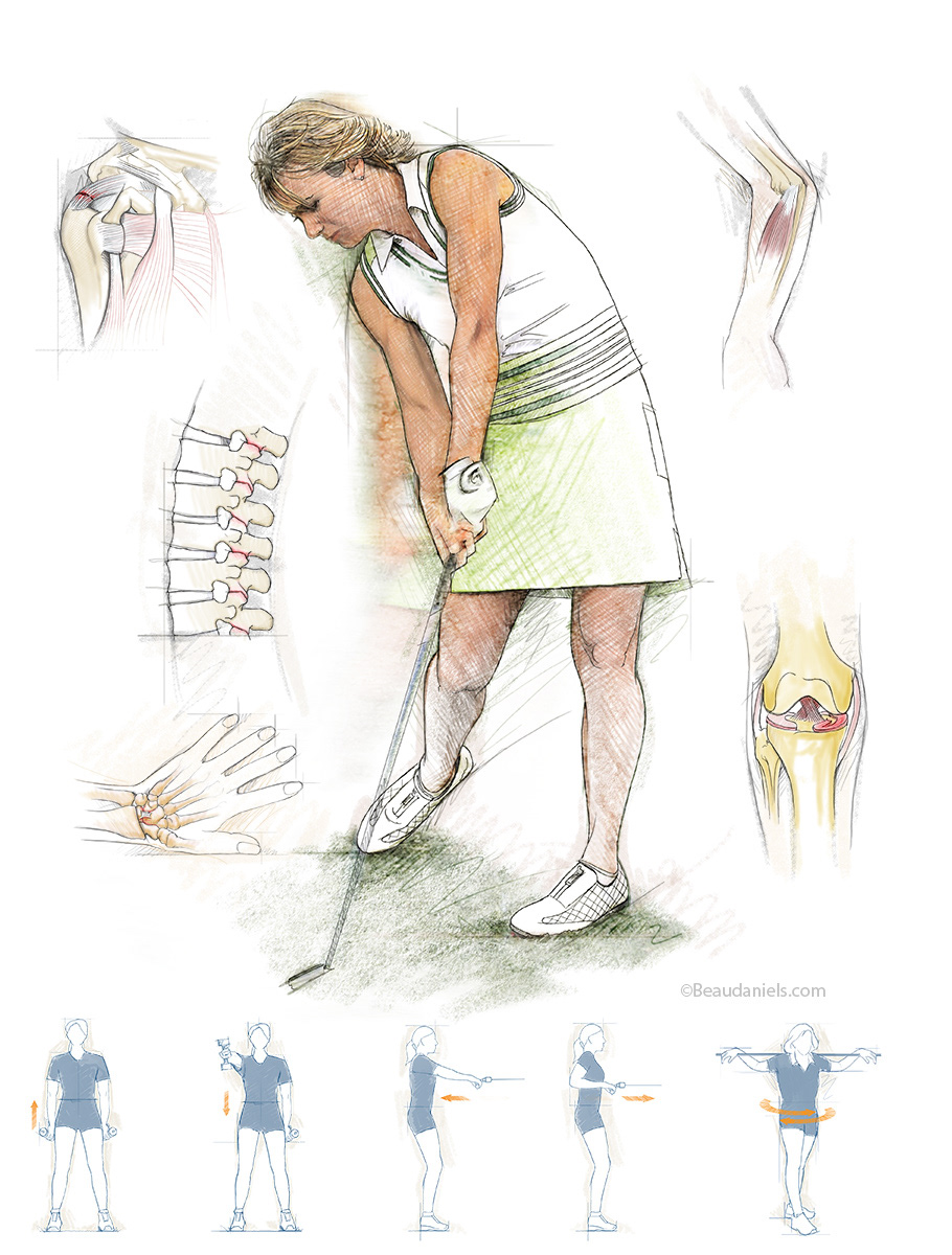 Golf injury information graphic.